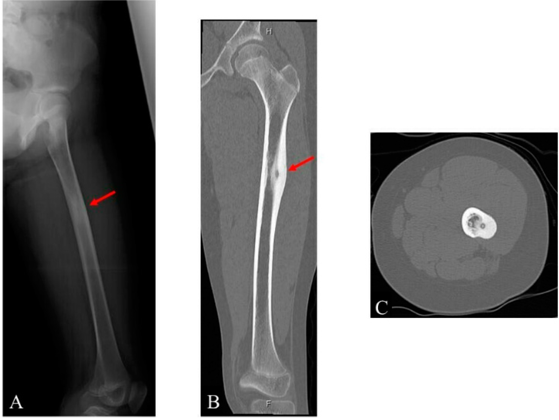 Children 09 00158 g001 Children 09 00158 g001