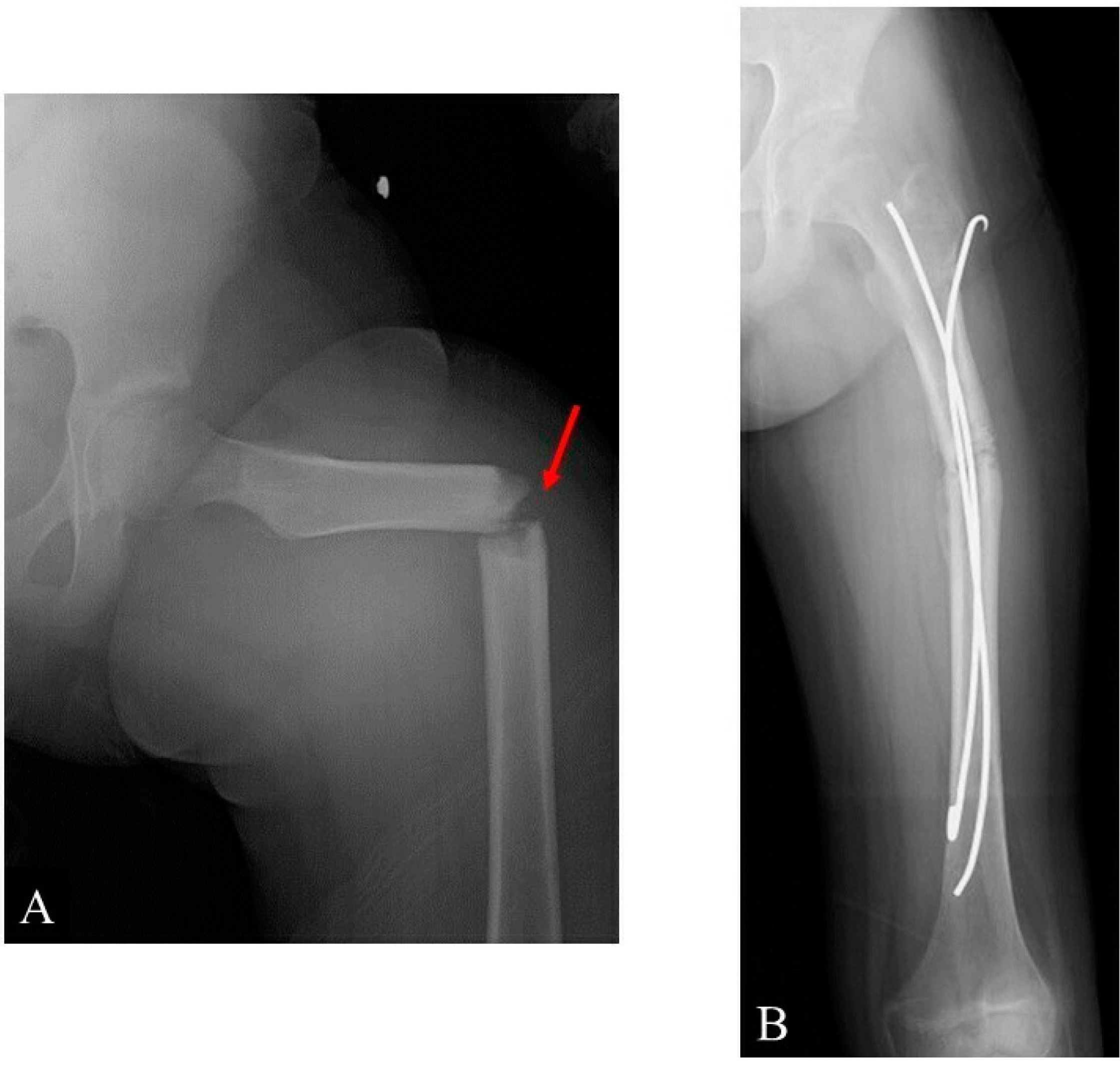 Children 09 00158 g005 Children 09 00158 g005