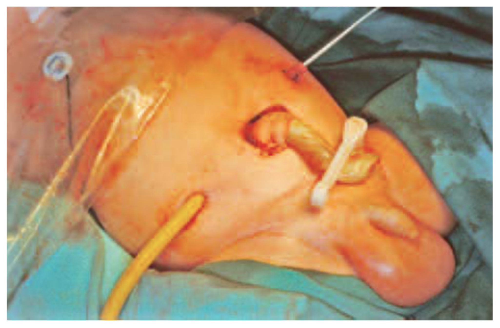 Children 09 00162 g002 Children 09 00162 g002