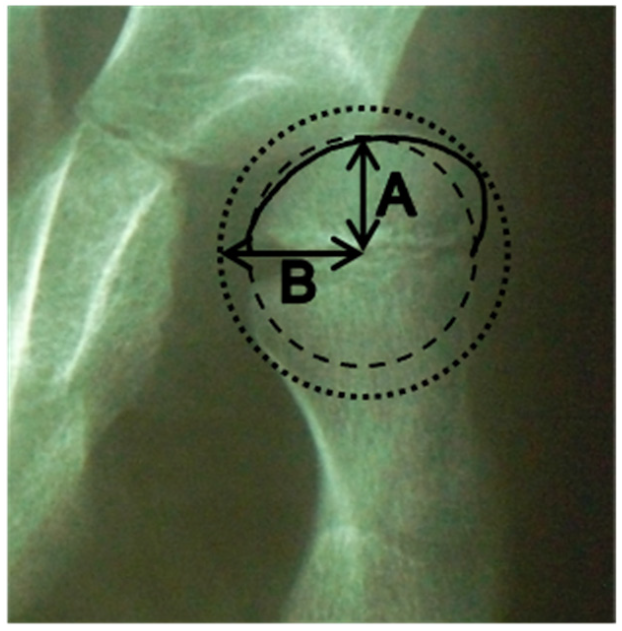 Children 09 00164 g001 550