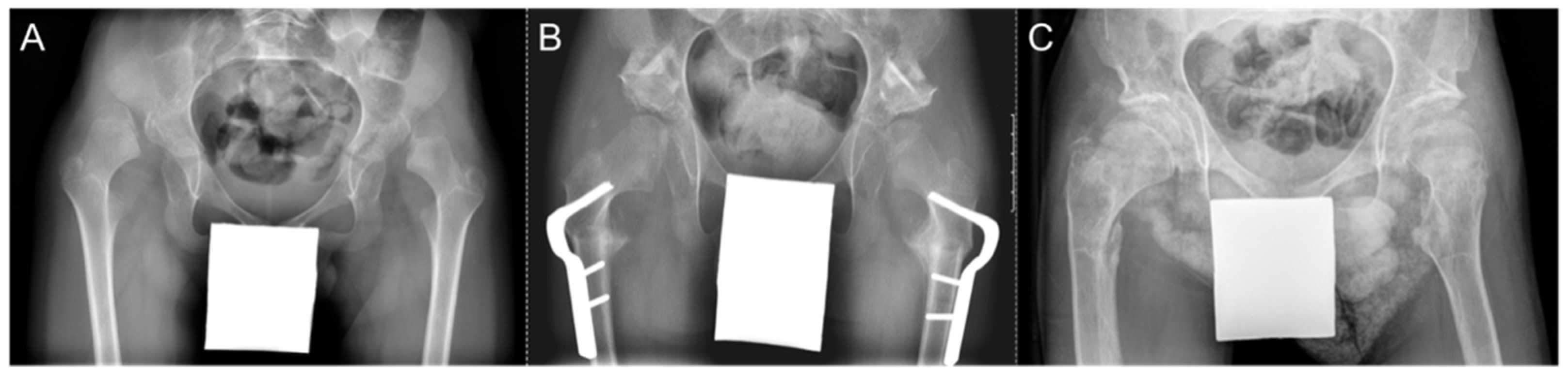 Children 09 00164 g005 550