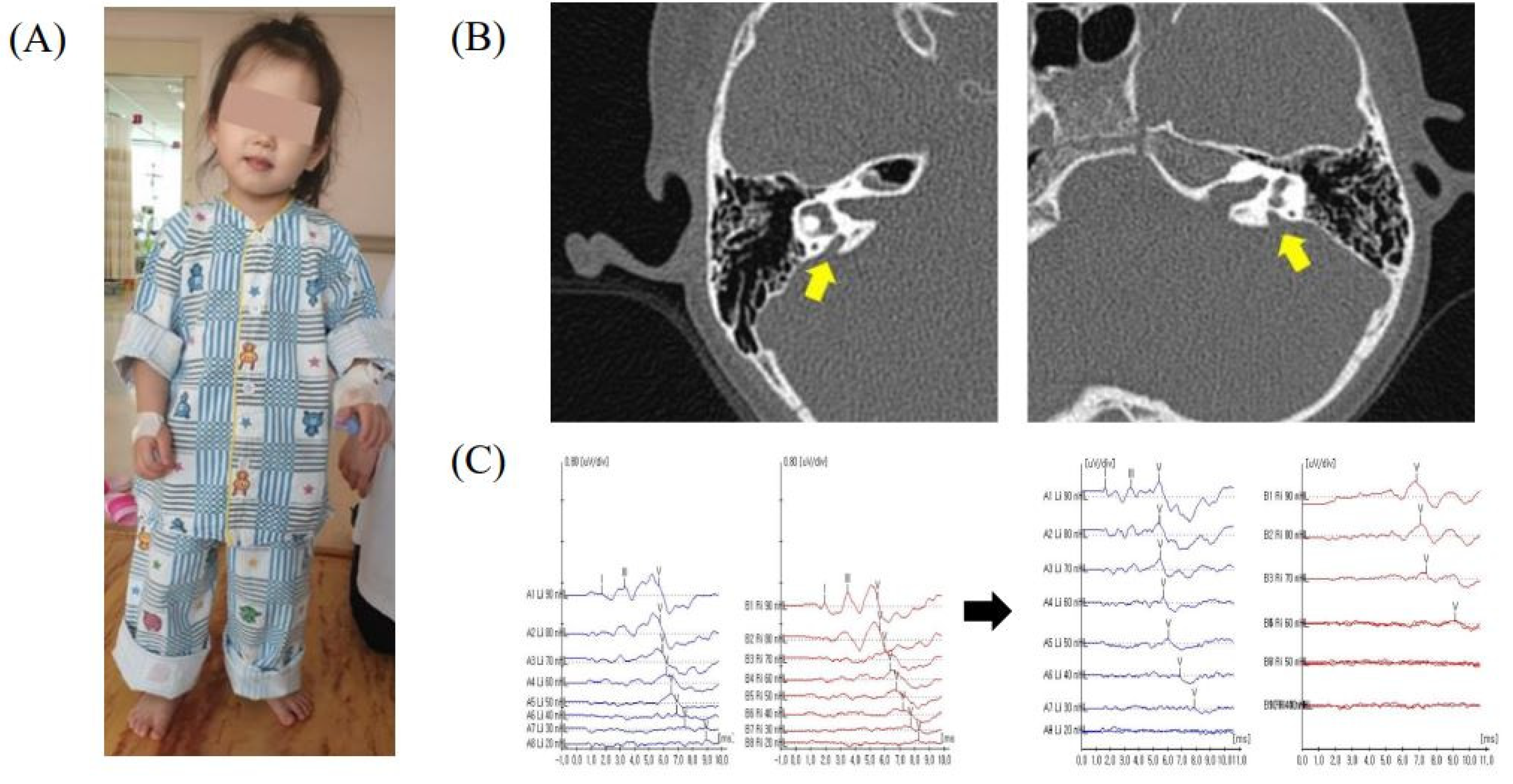 Children 09 00165 g002 550