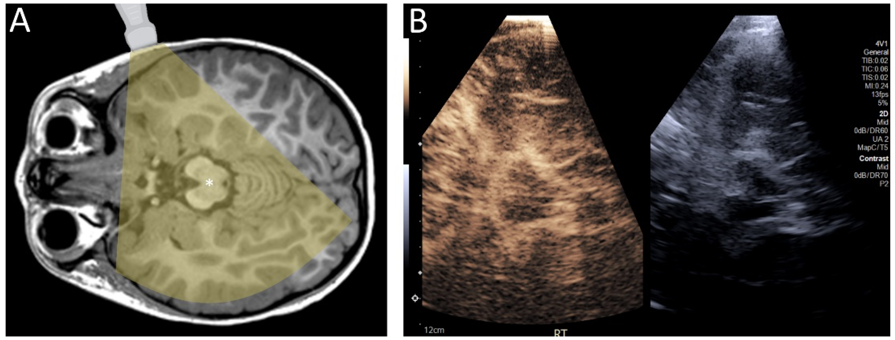 Children 09 00170 g004