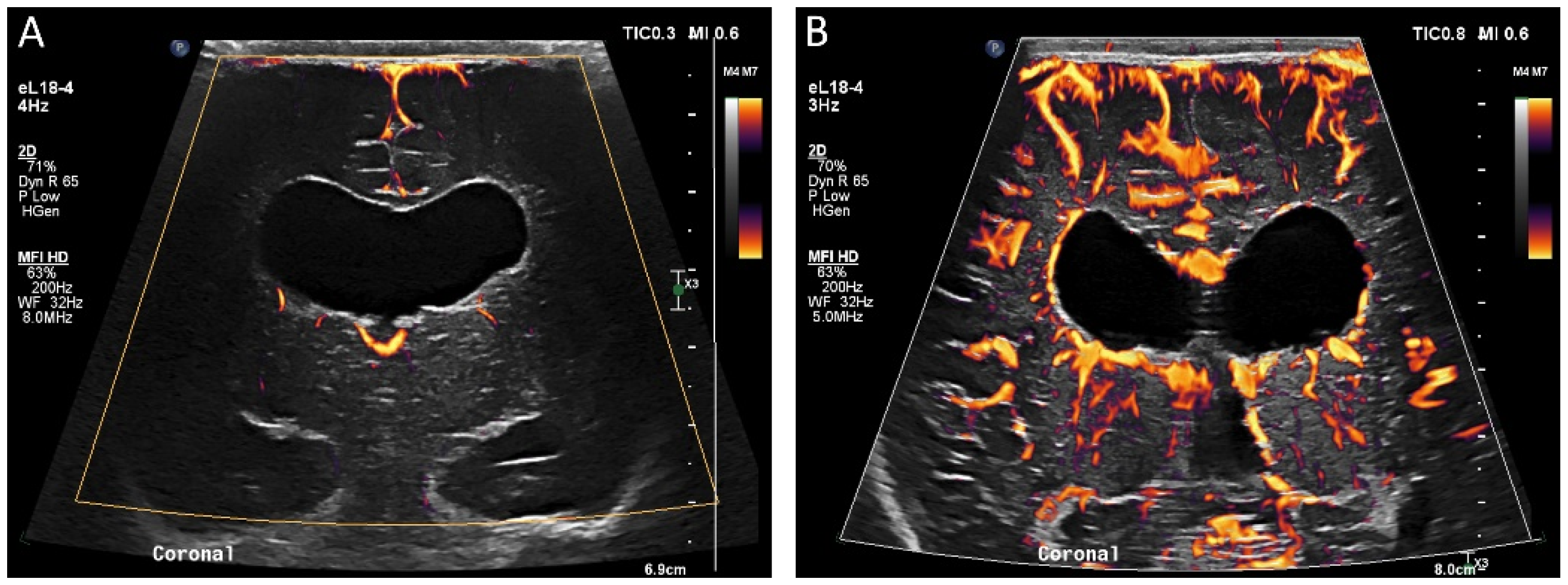 Children 09 00170 g005