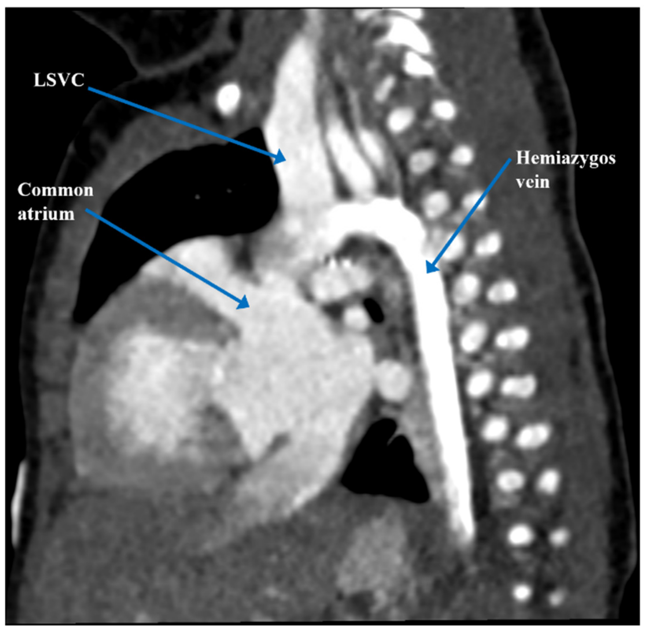 Children 09 00184 g002 Children 09 00184 g002