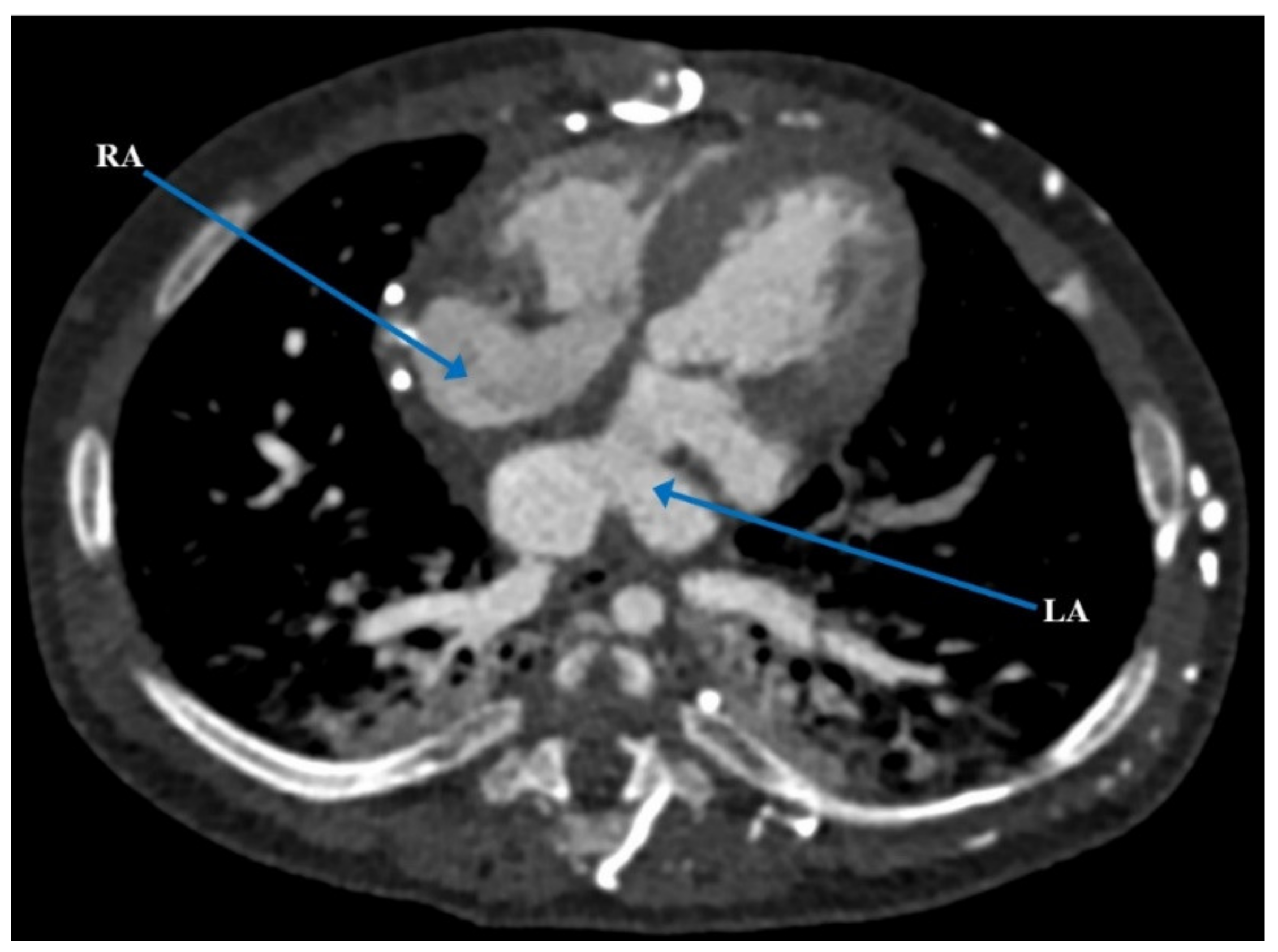 Children 09 00184 g005 Children 09 00184 g005