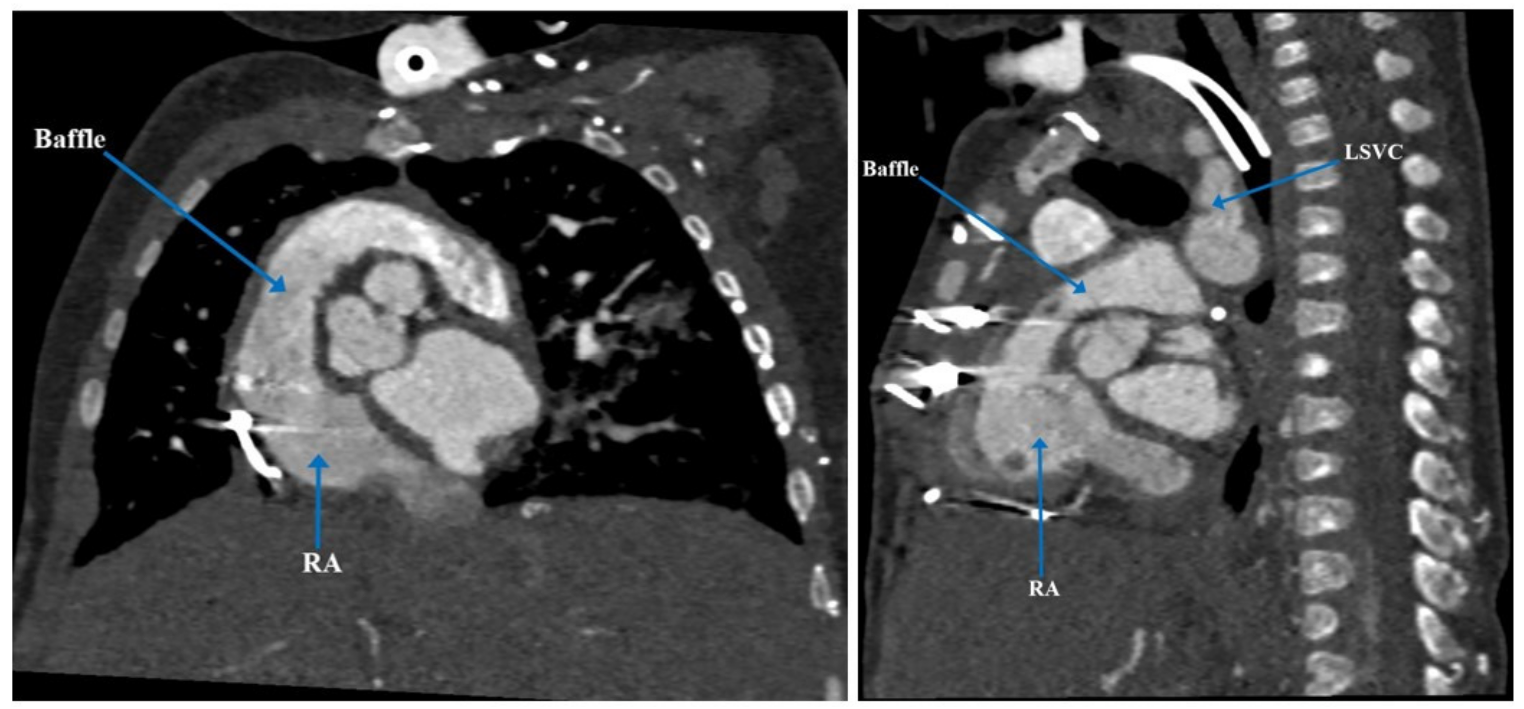 Children 09 00184 g006 Children 09 00184 g006