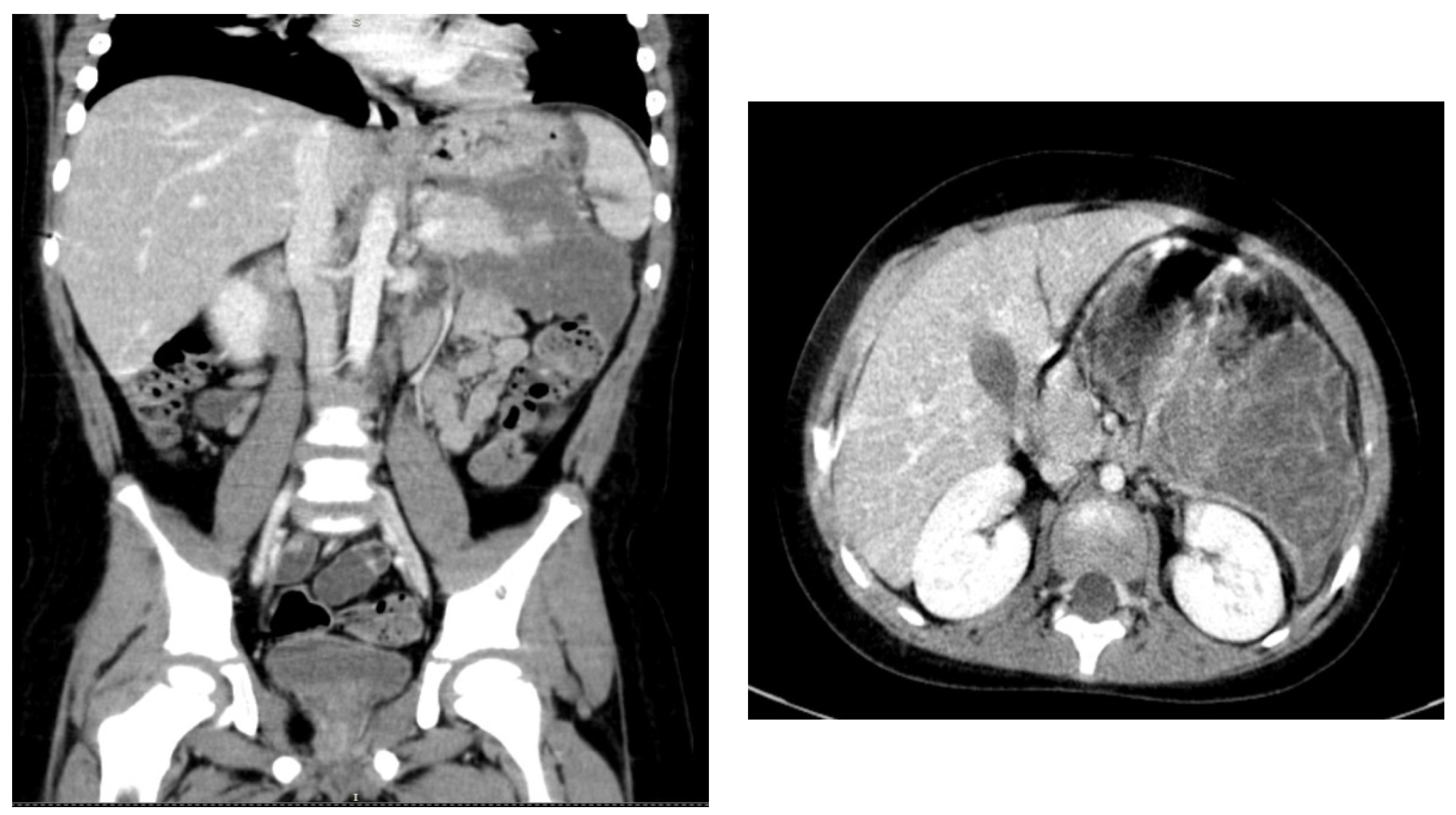 Children 09 00188 g001 Children 09 00188 g001