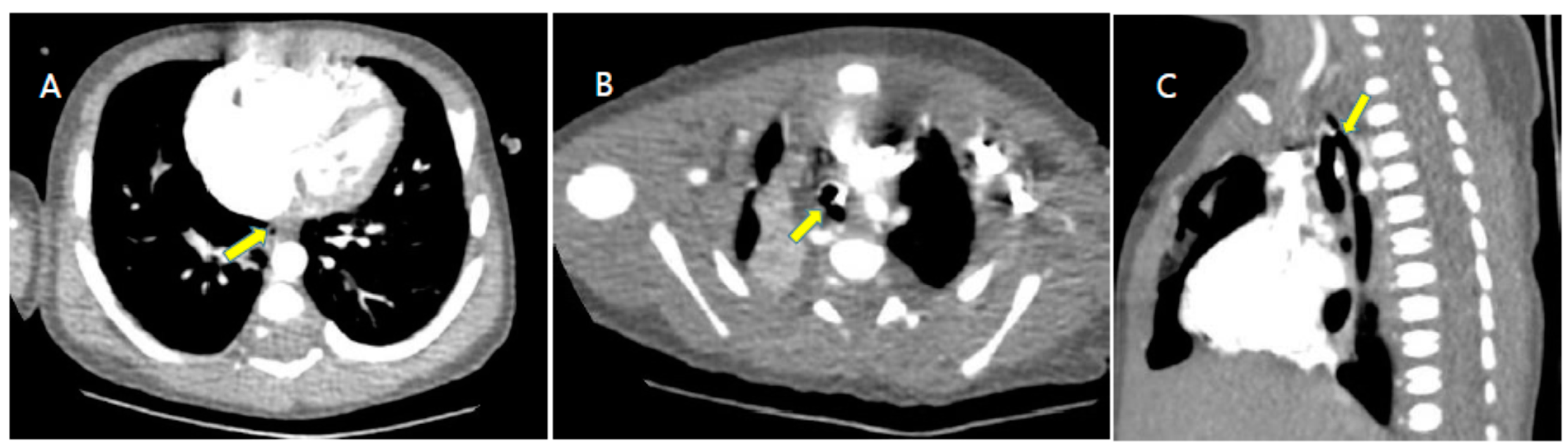 Children 09 00194 g001 Children 09 00194 g001