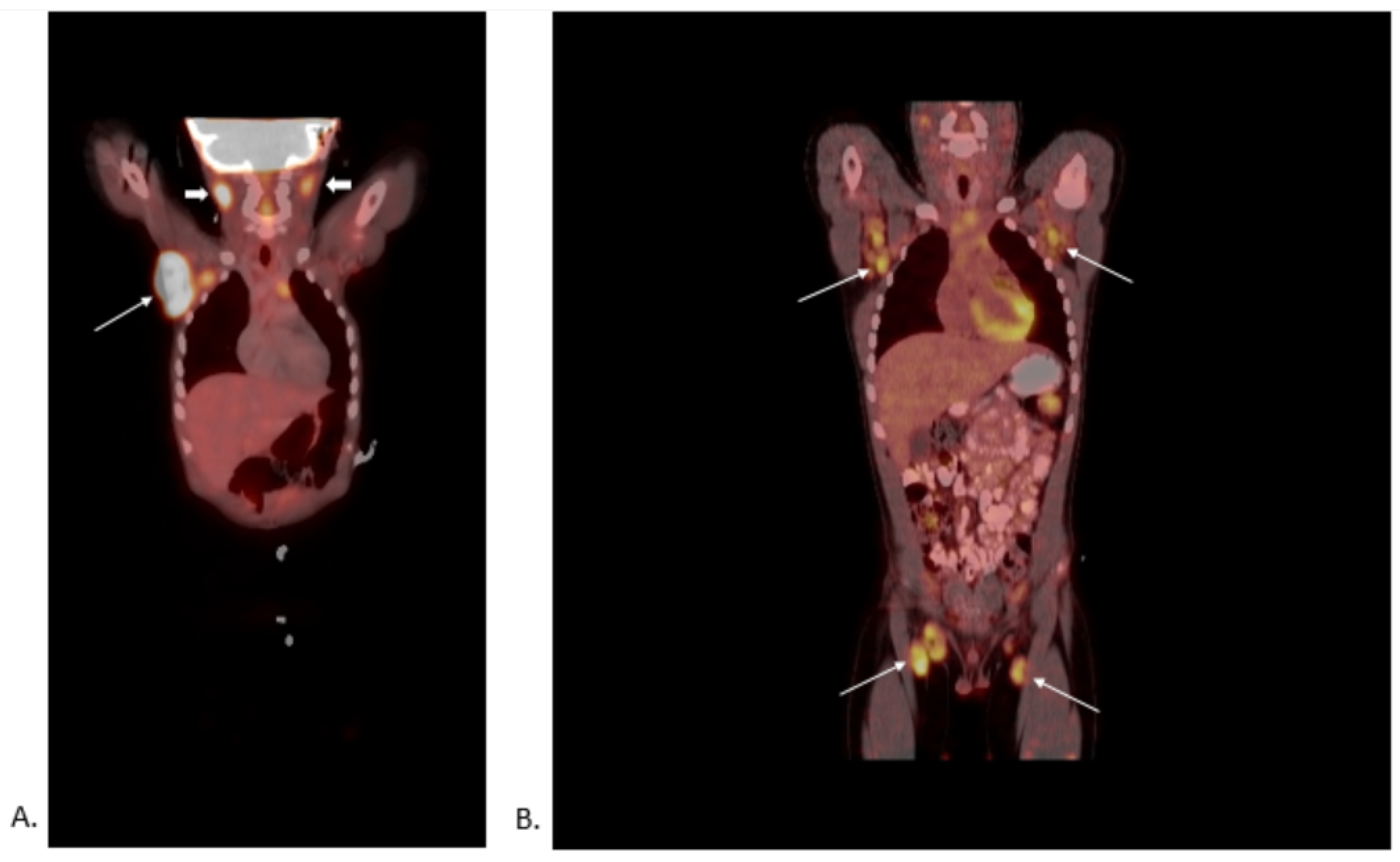 Children 09 00214 g001