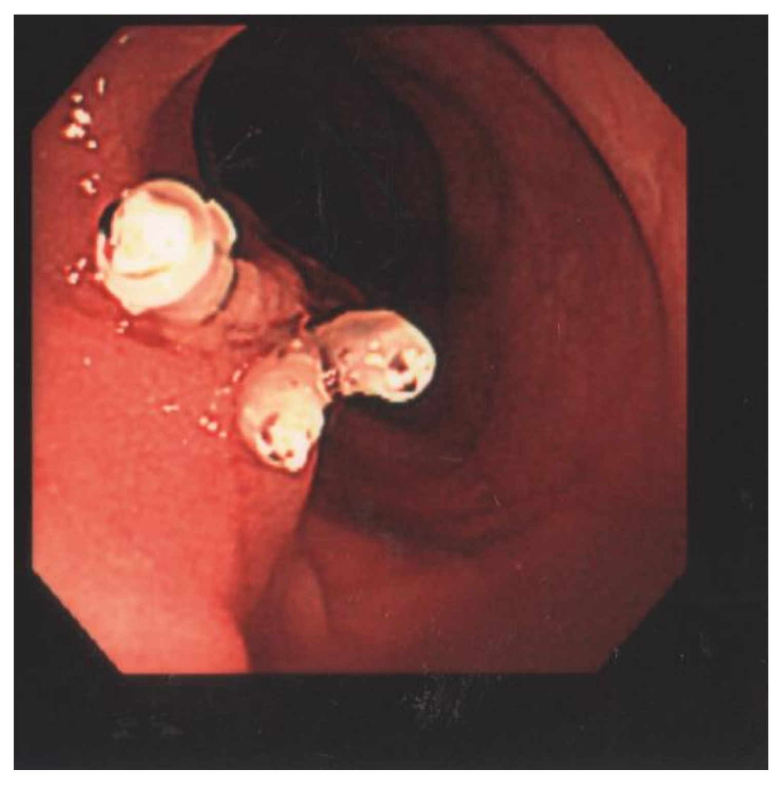 Children 09 00222 g004 550