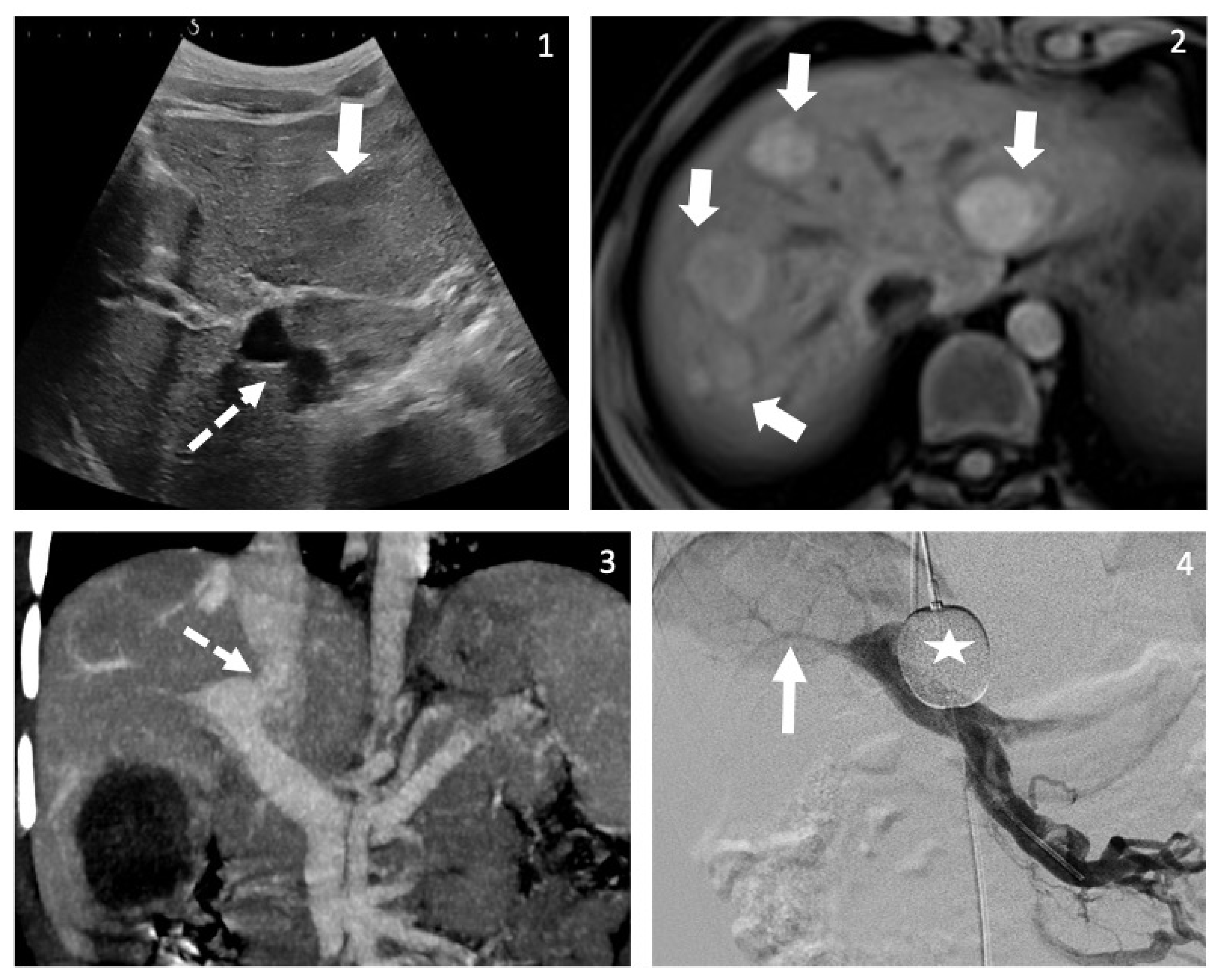 Children 09 00243 g002