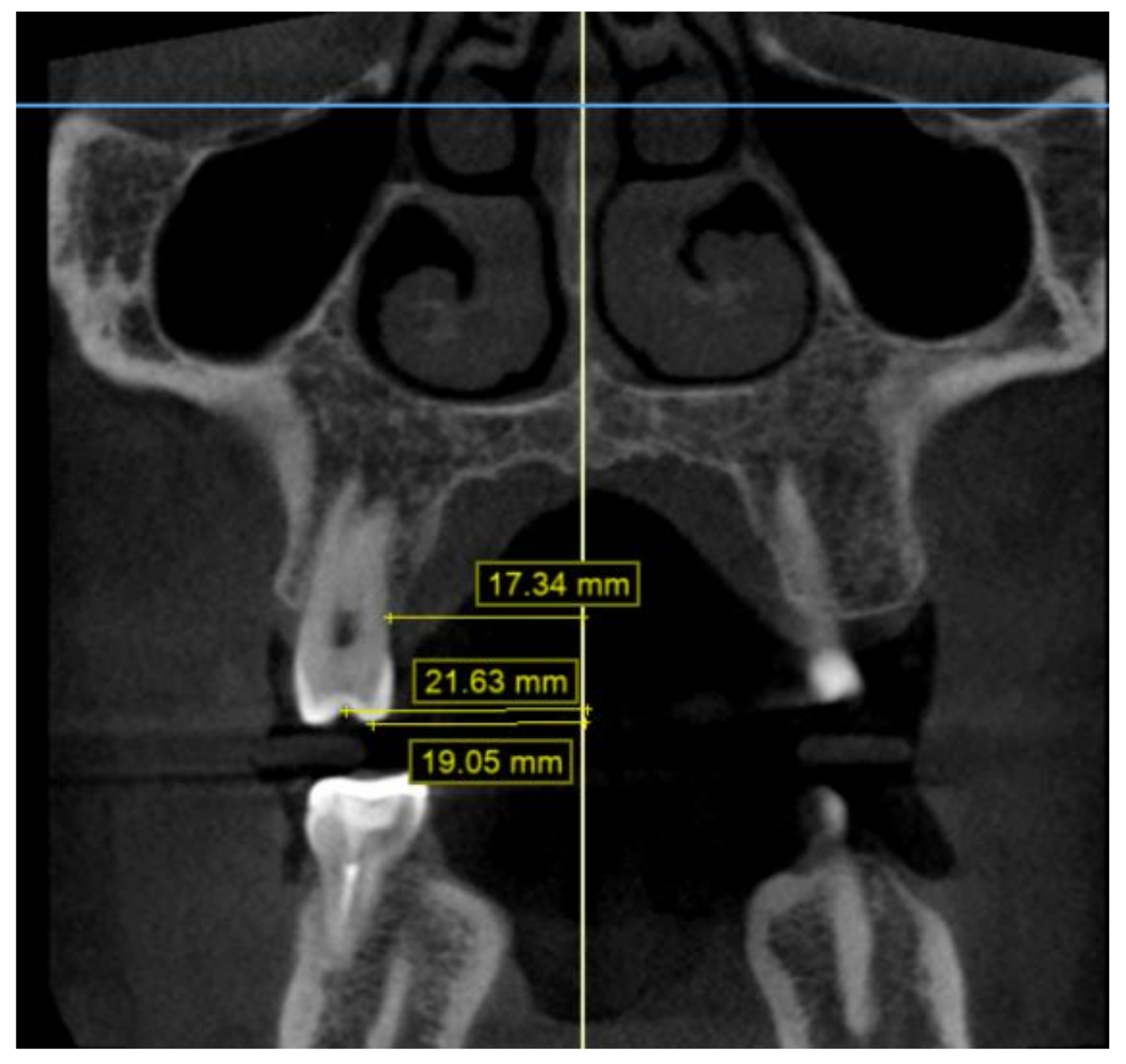 Children 09 00278 g006