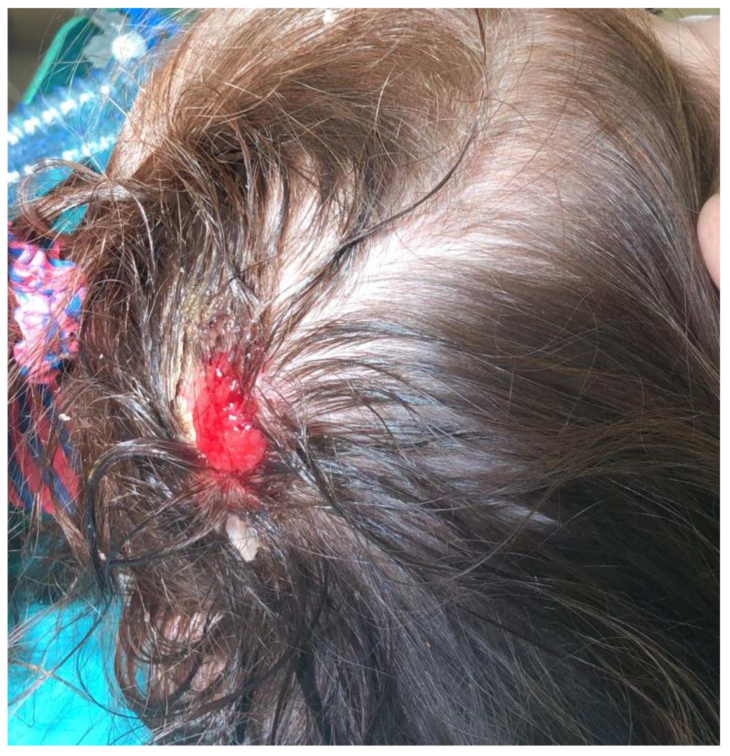 Children 09 00292 g002 550