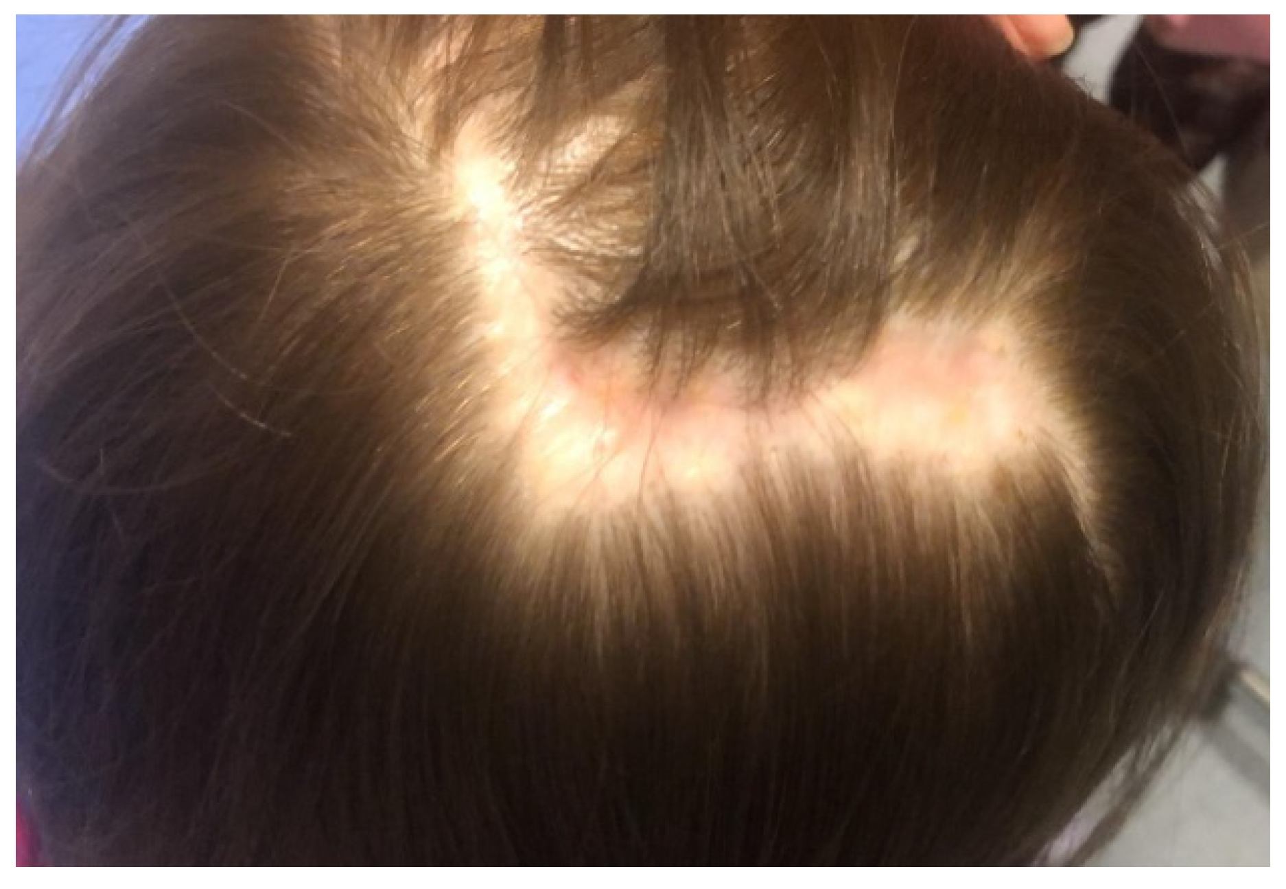 Children 09 00292 g004 550