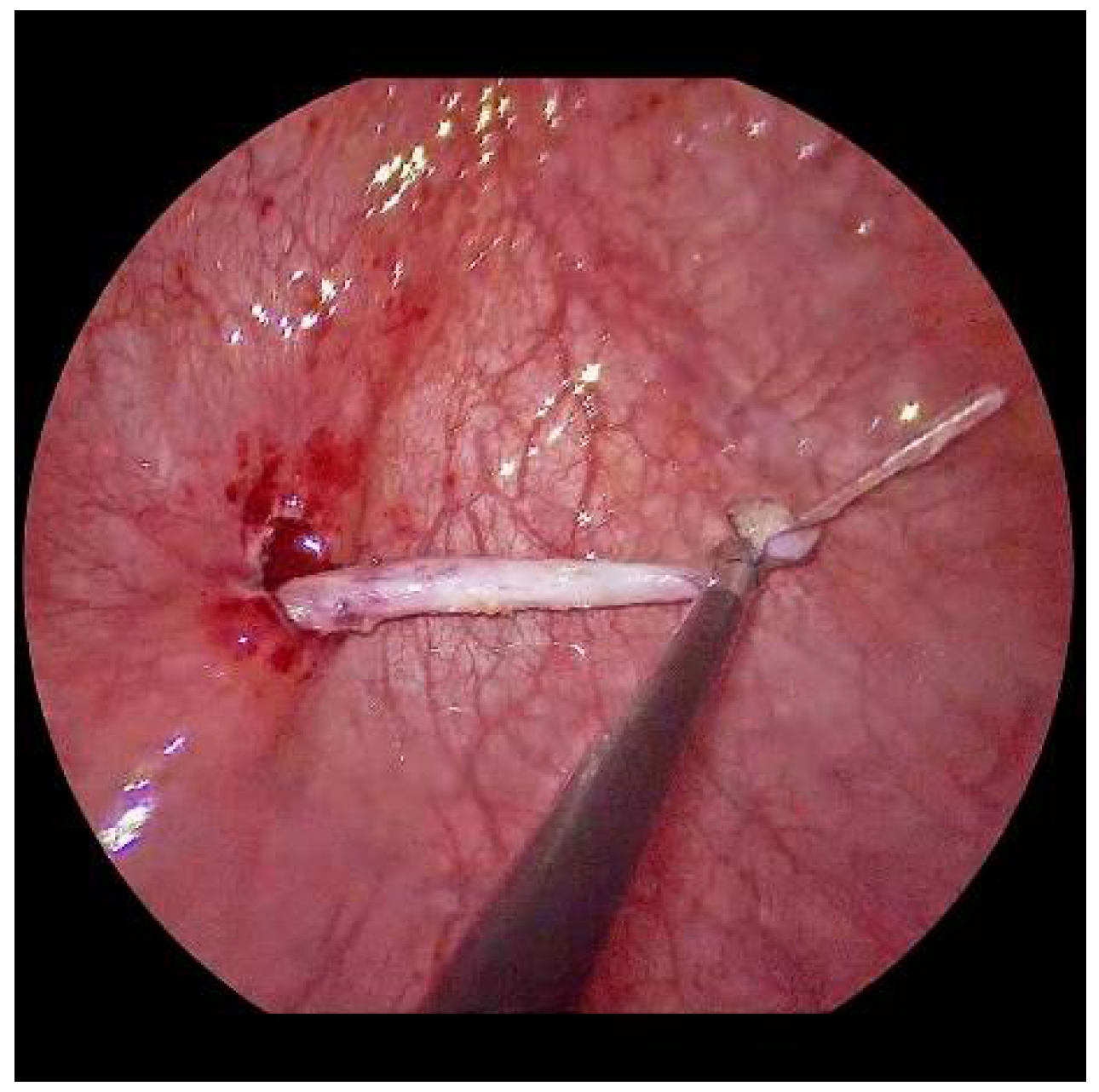 Children 09 00298 g004 550