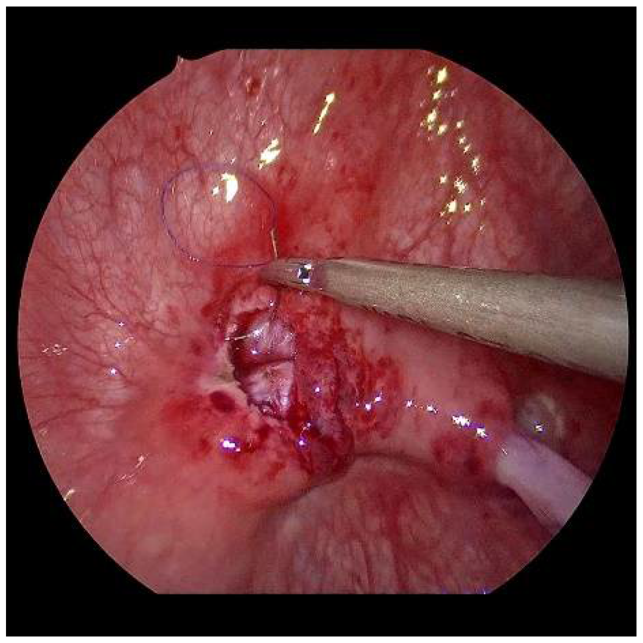 Children 09 00298 g006 550