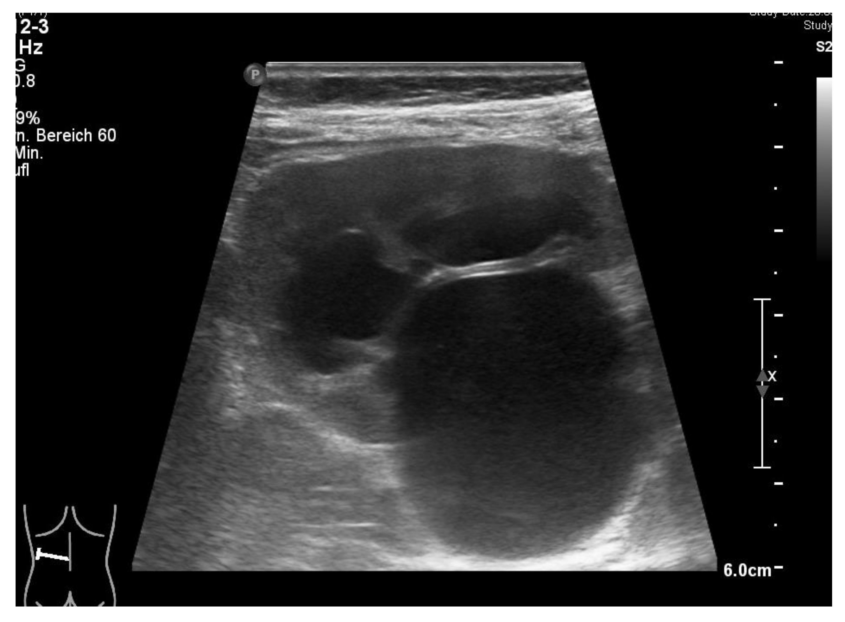 Children 09 00302 g001 550