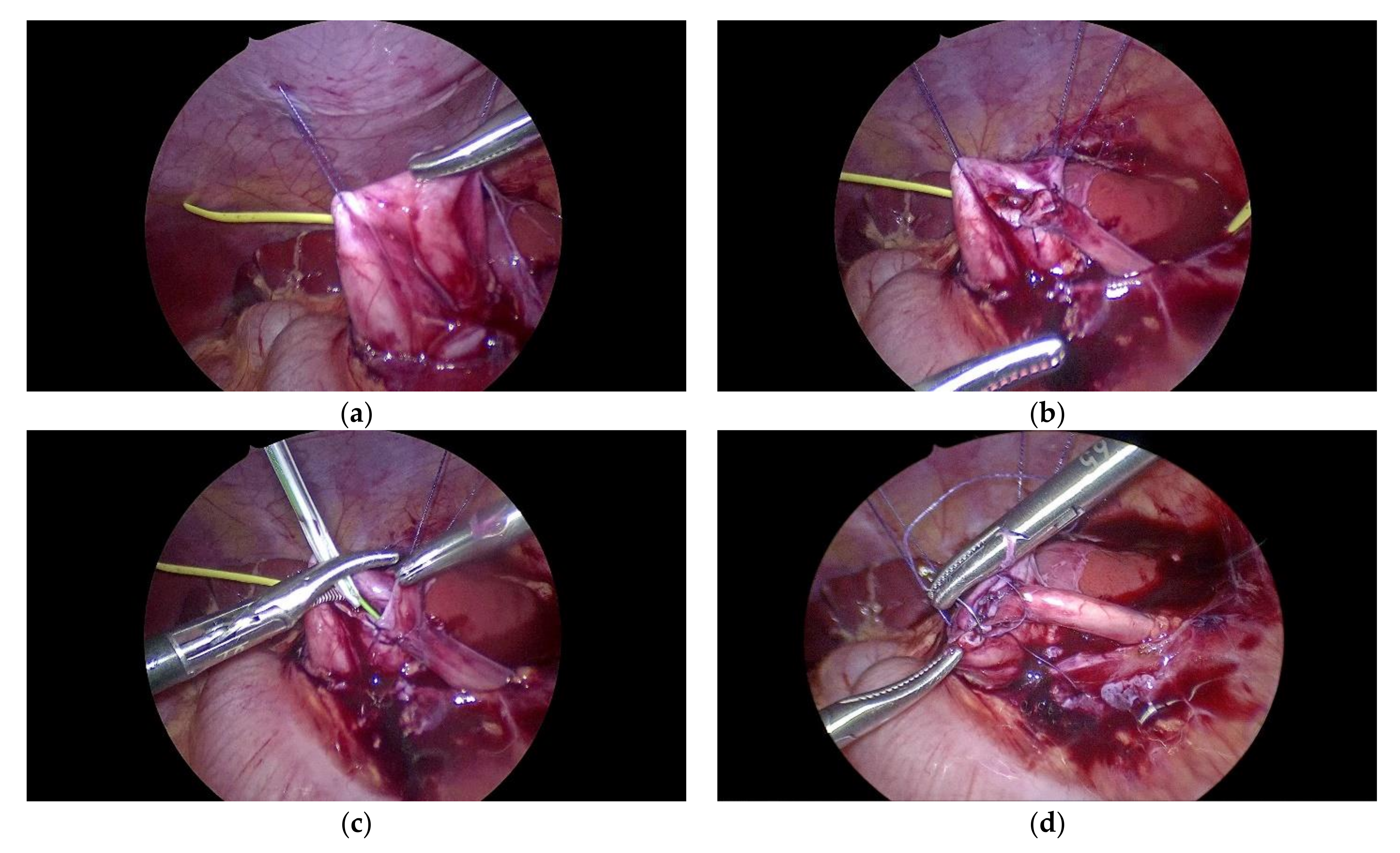 Children 09 00302 g005 550