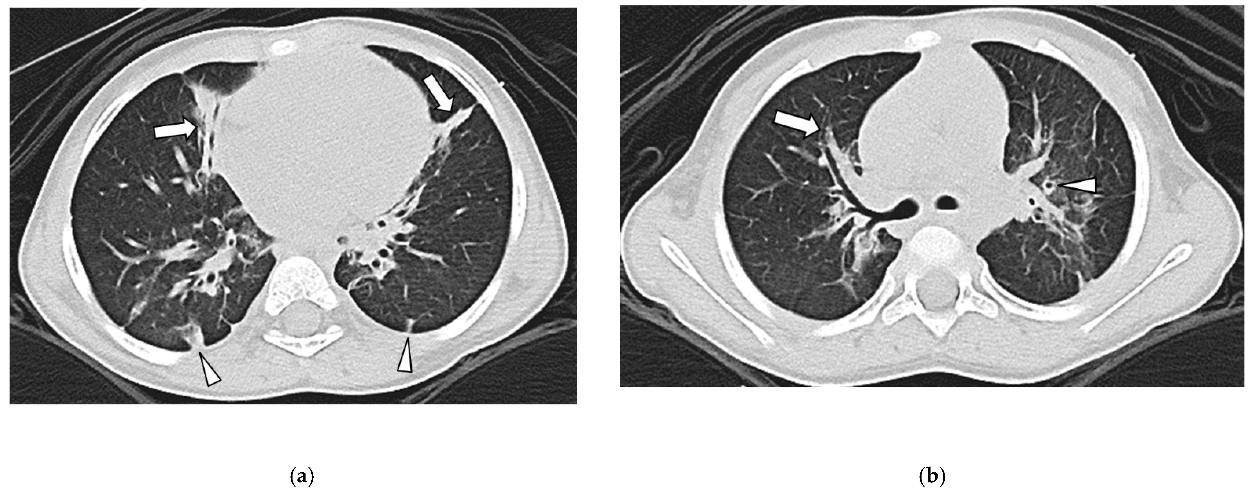 Children 09 00355 g003 550