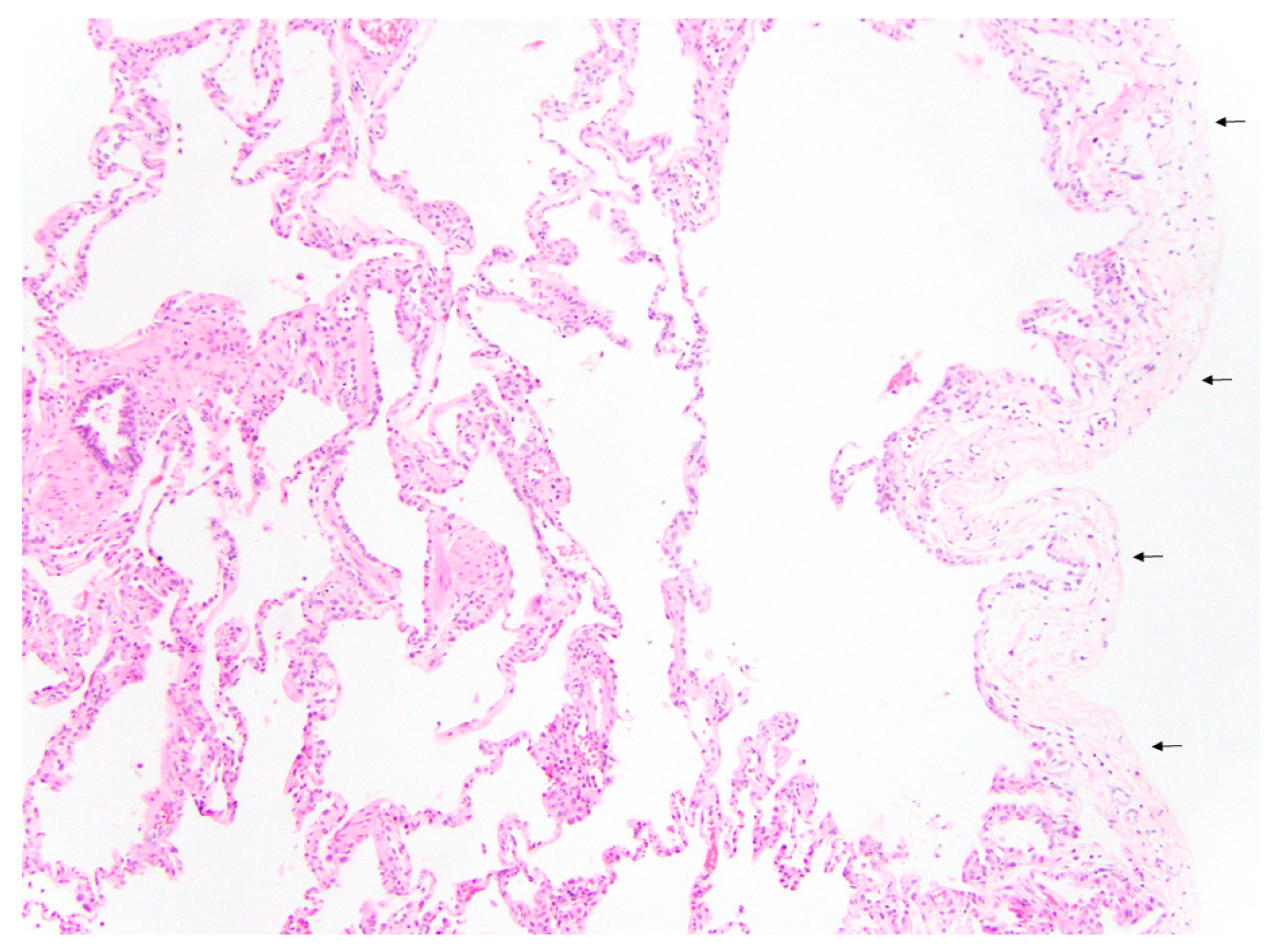 Children 09 00355 g004 550