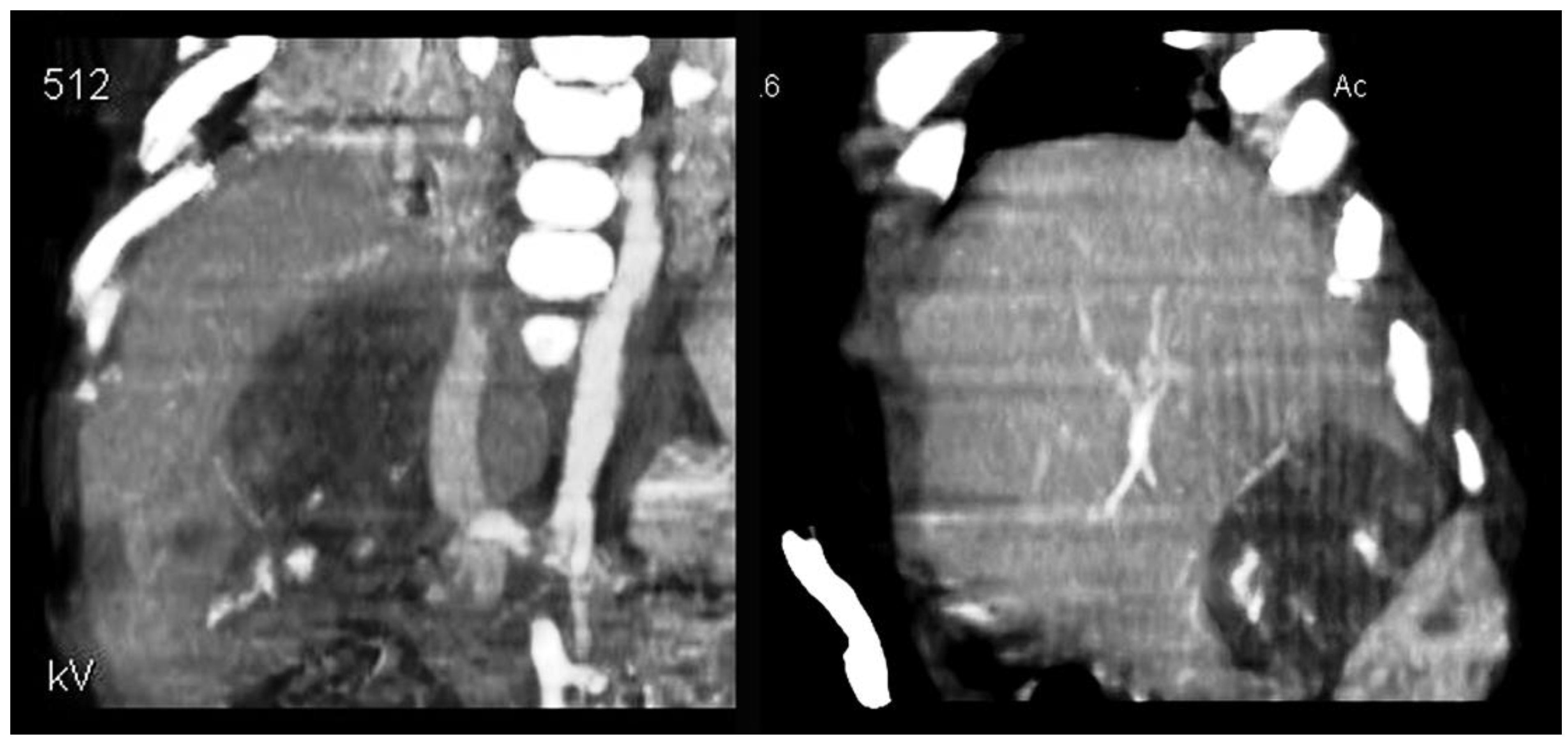 Children 09 00418 g001 550