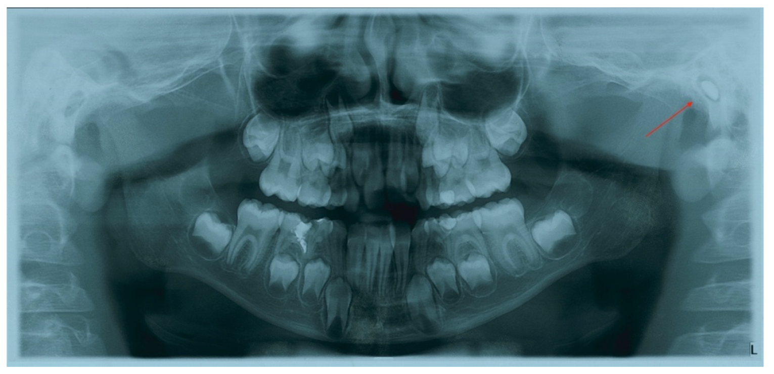 Children 09 00421 g002