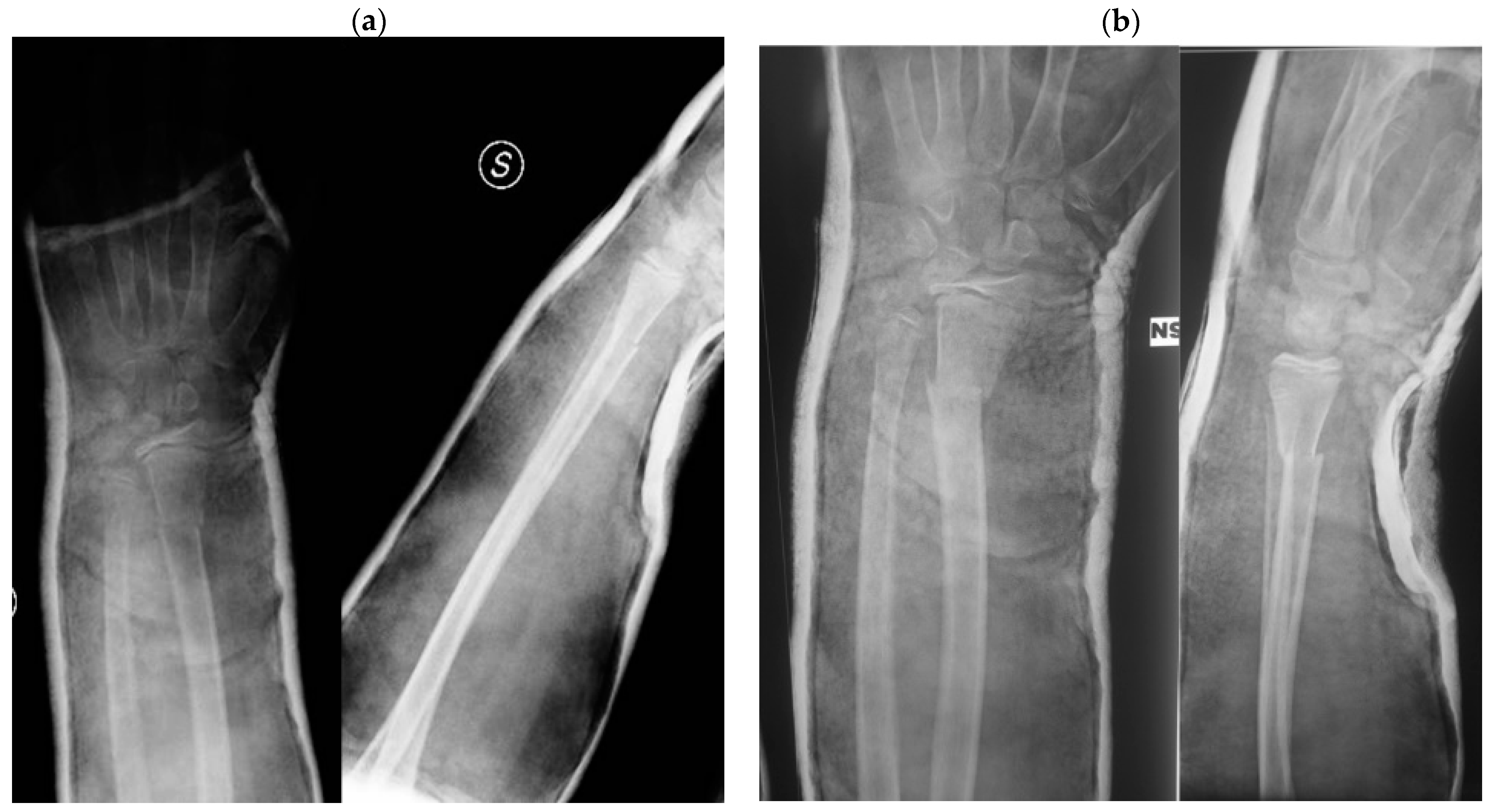 Children 09 00425 g002a