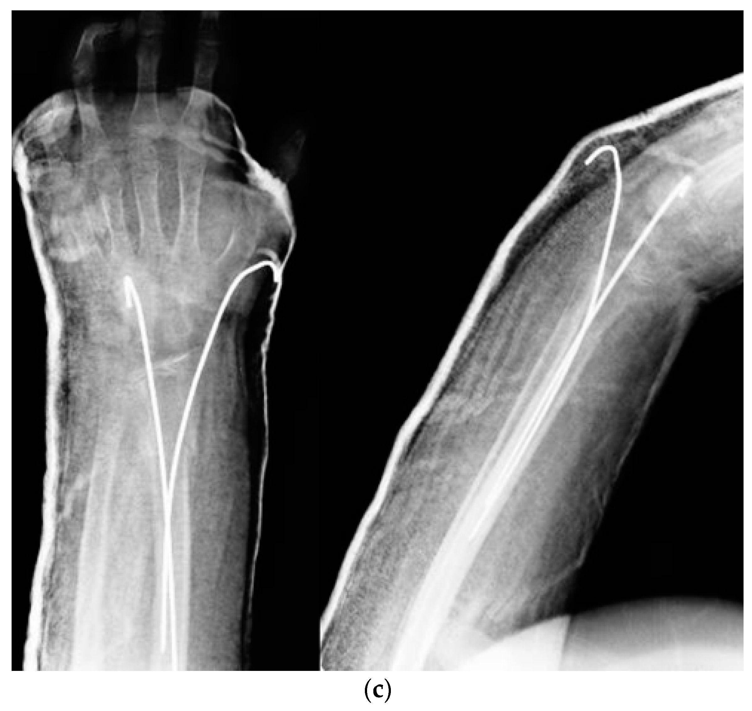 Children 09 00425 g002b