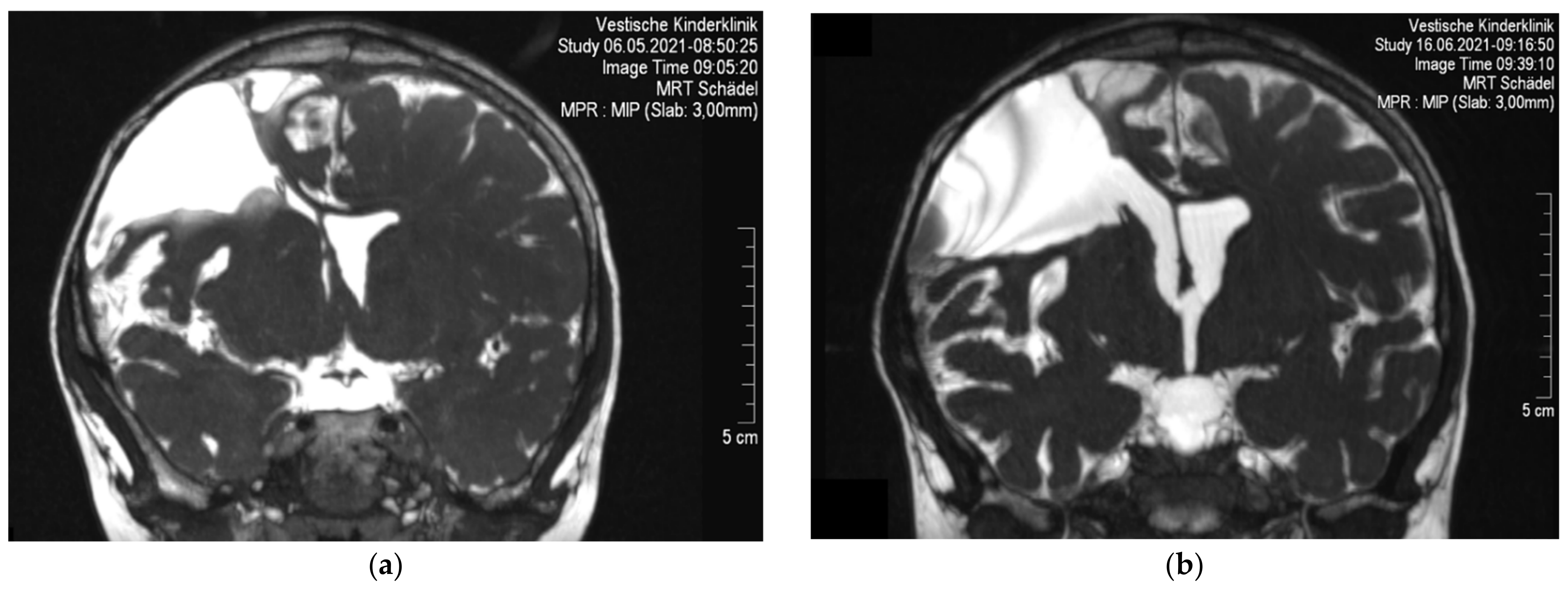 Children 09 00432 g002 550