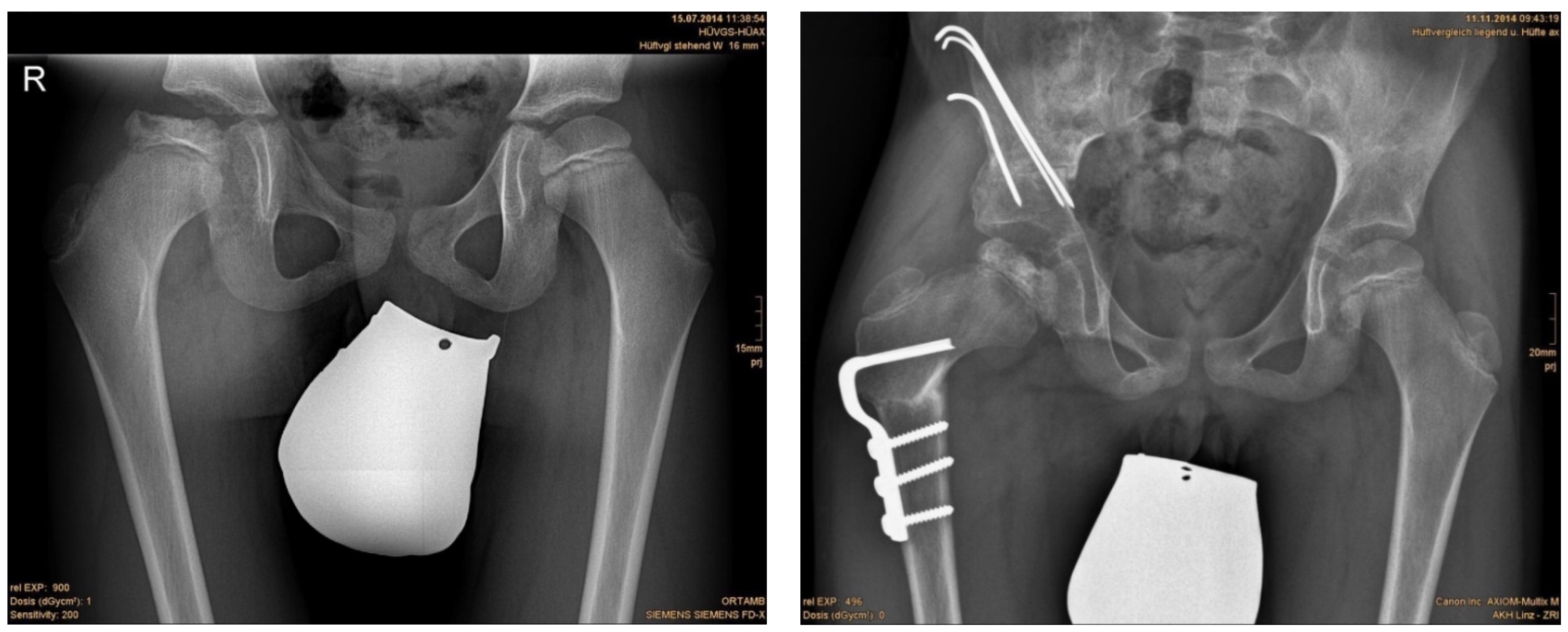 Children 09 00441 g002 550