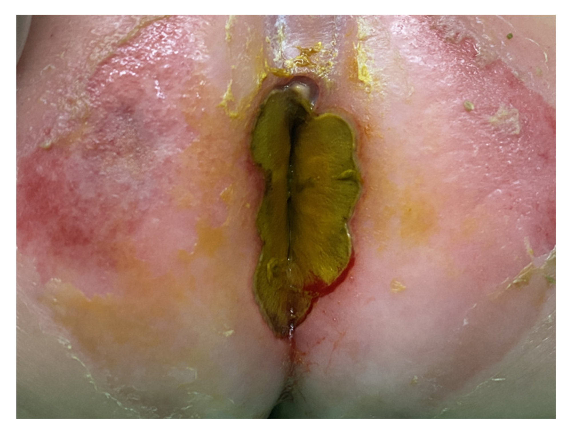 Children 09 00454 g001 550