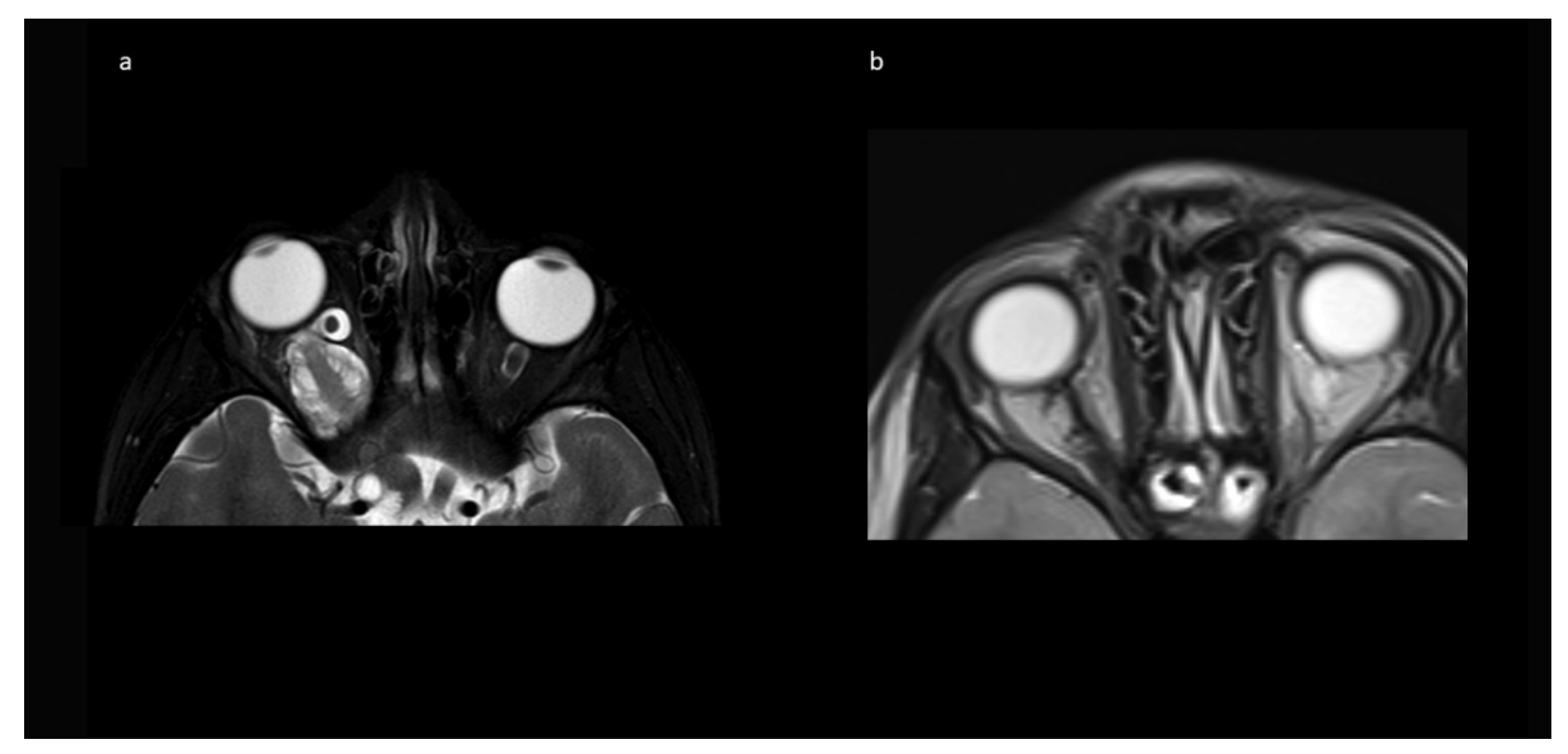 Children 09 00459 g004 550