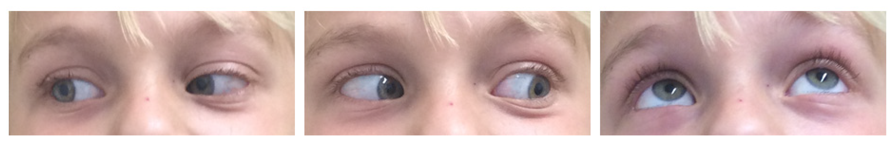 Children 09 00459 g005 550