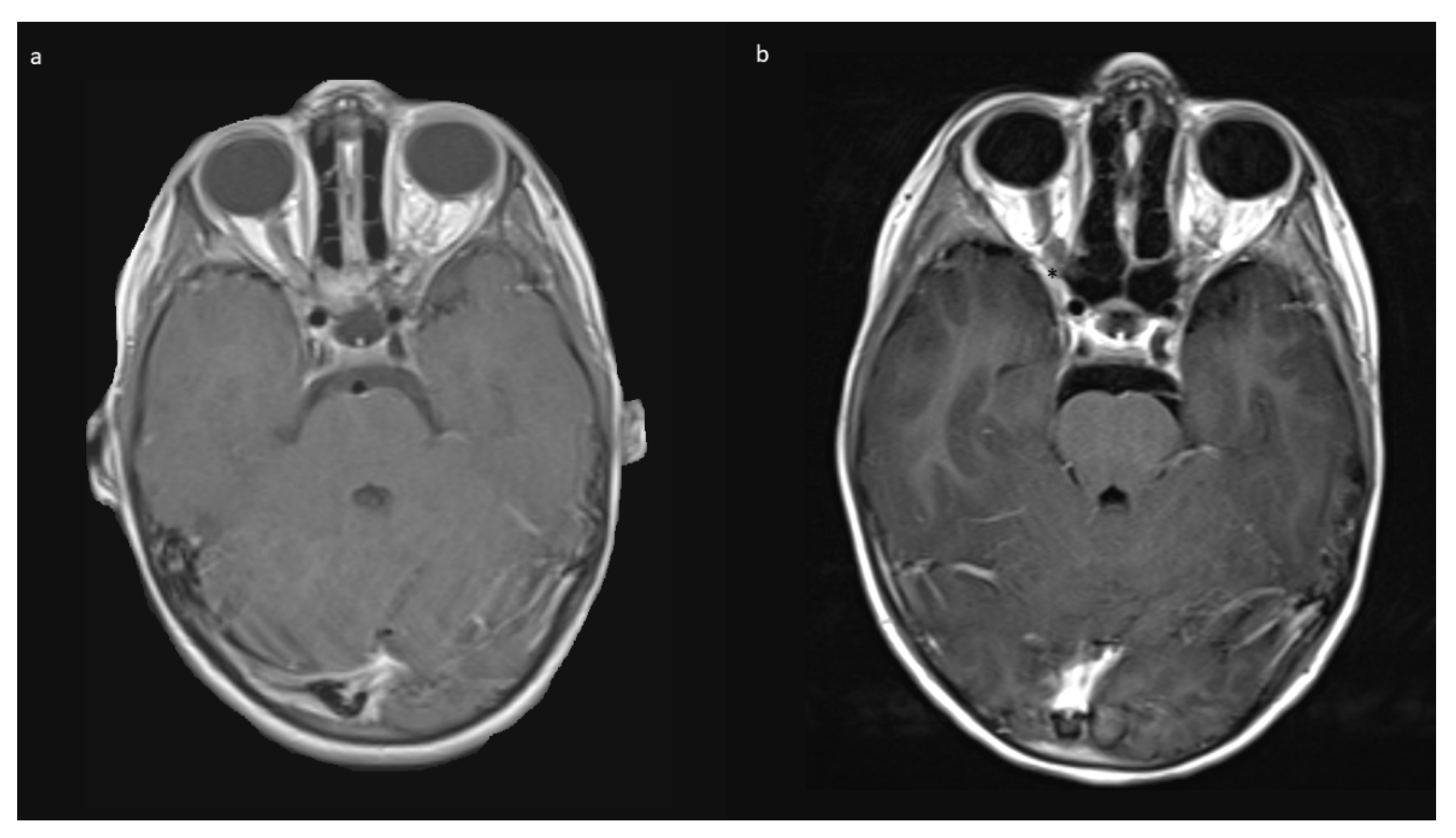 Children 09 00459 g007 550