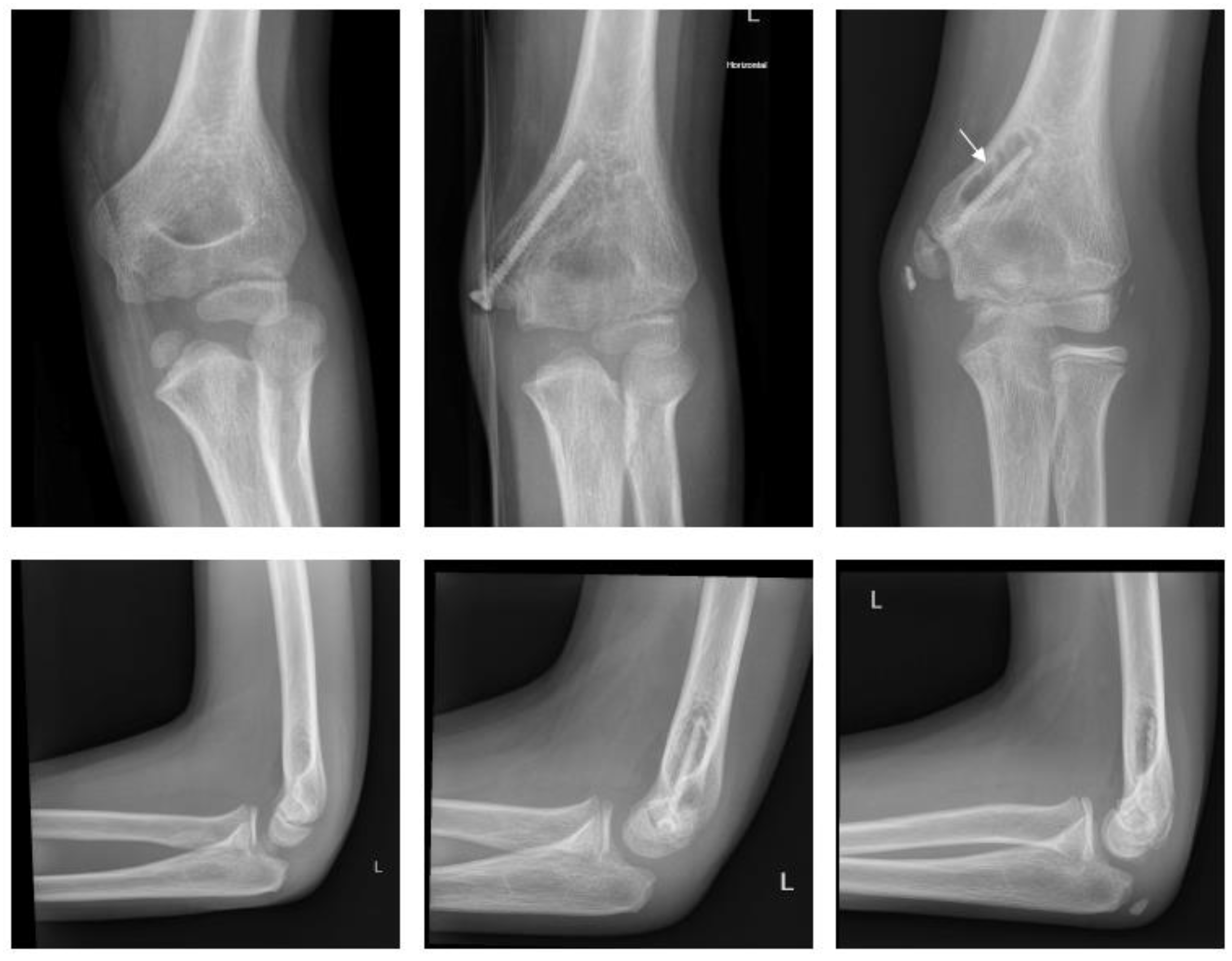 Children 09 00471 g003