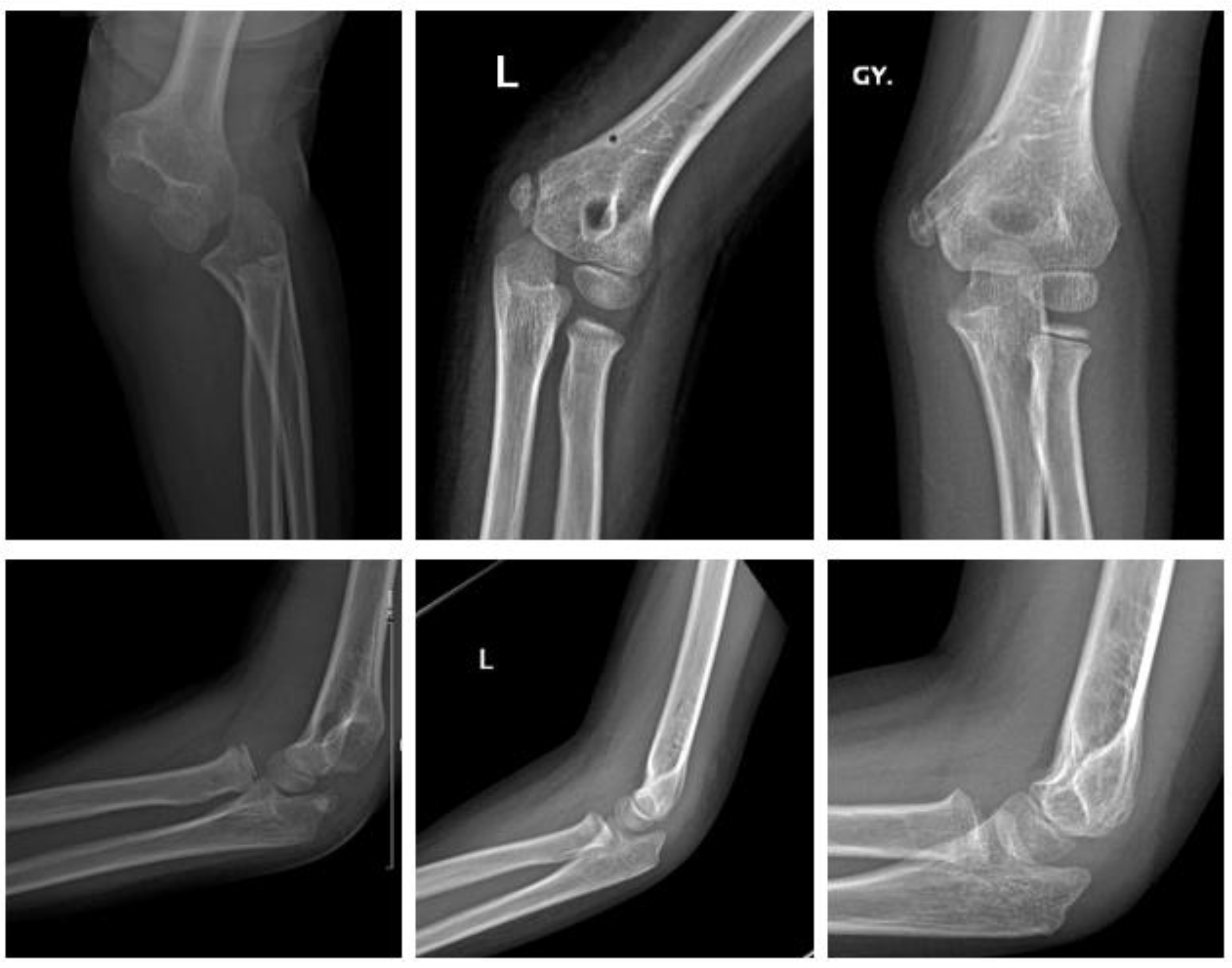 Children 09 00471 g004