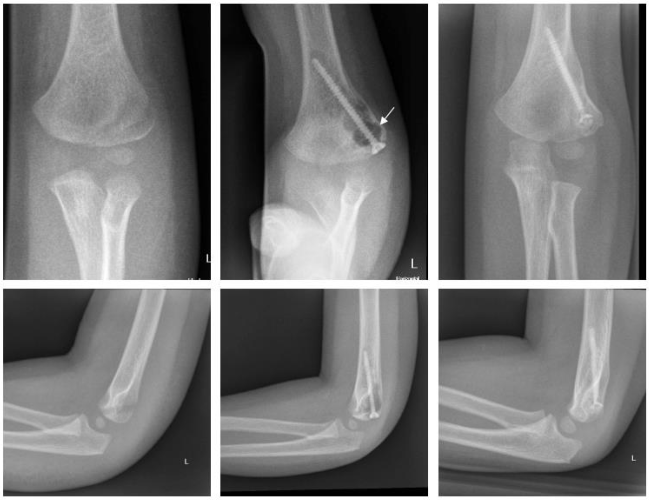 Children 09 00471 g005