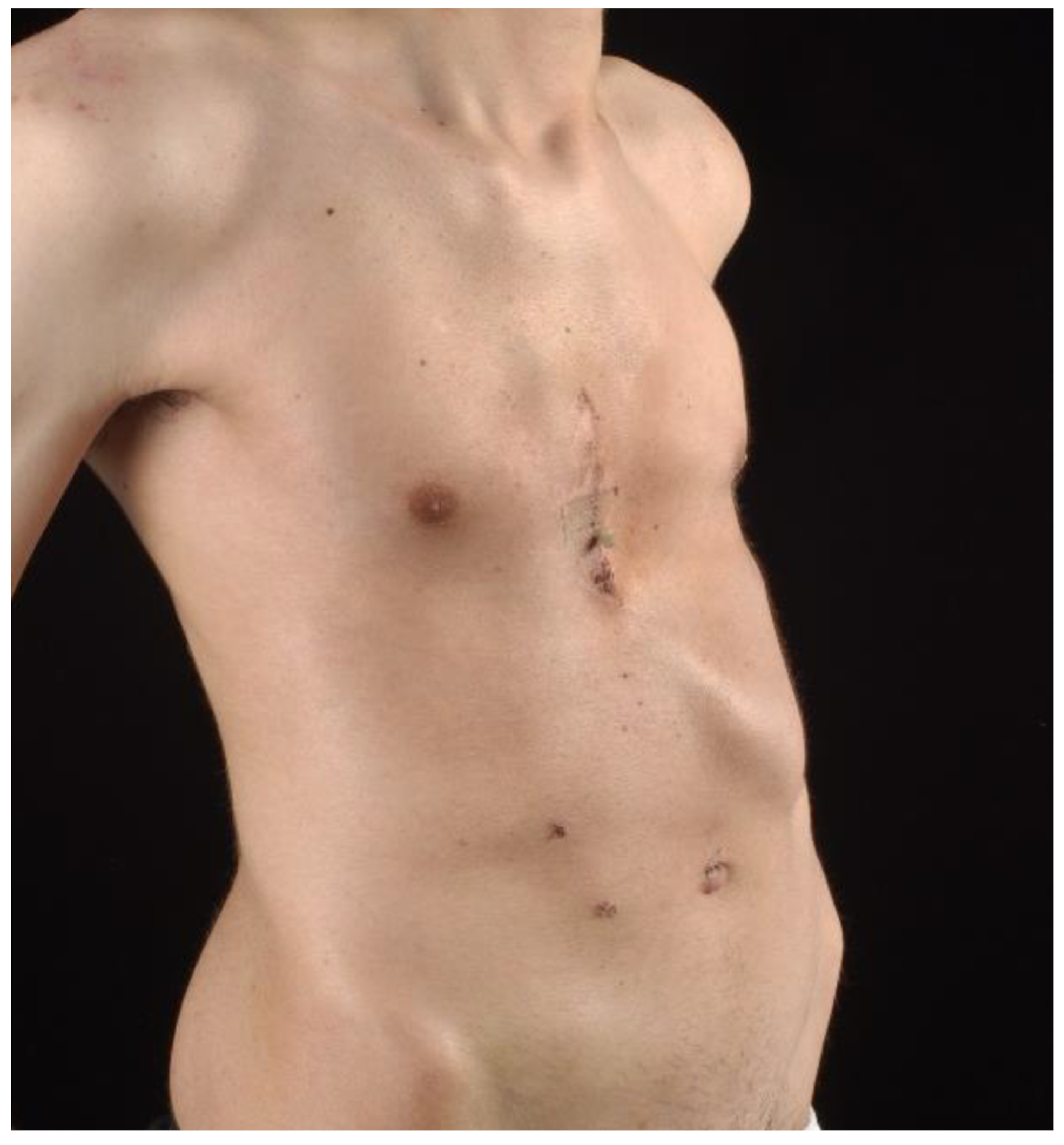 Children 09 00478 g002