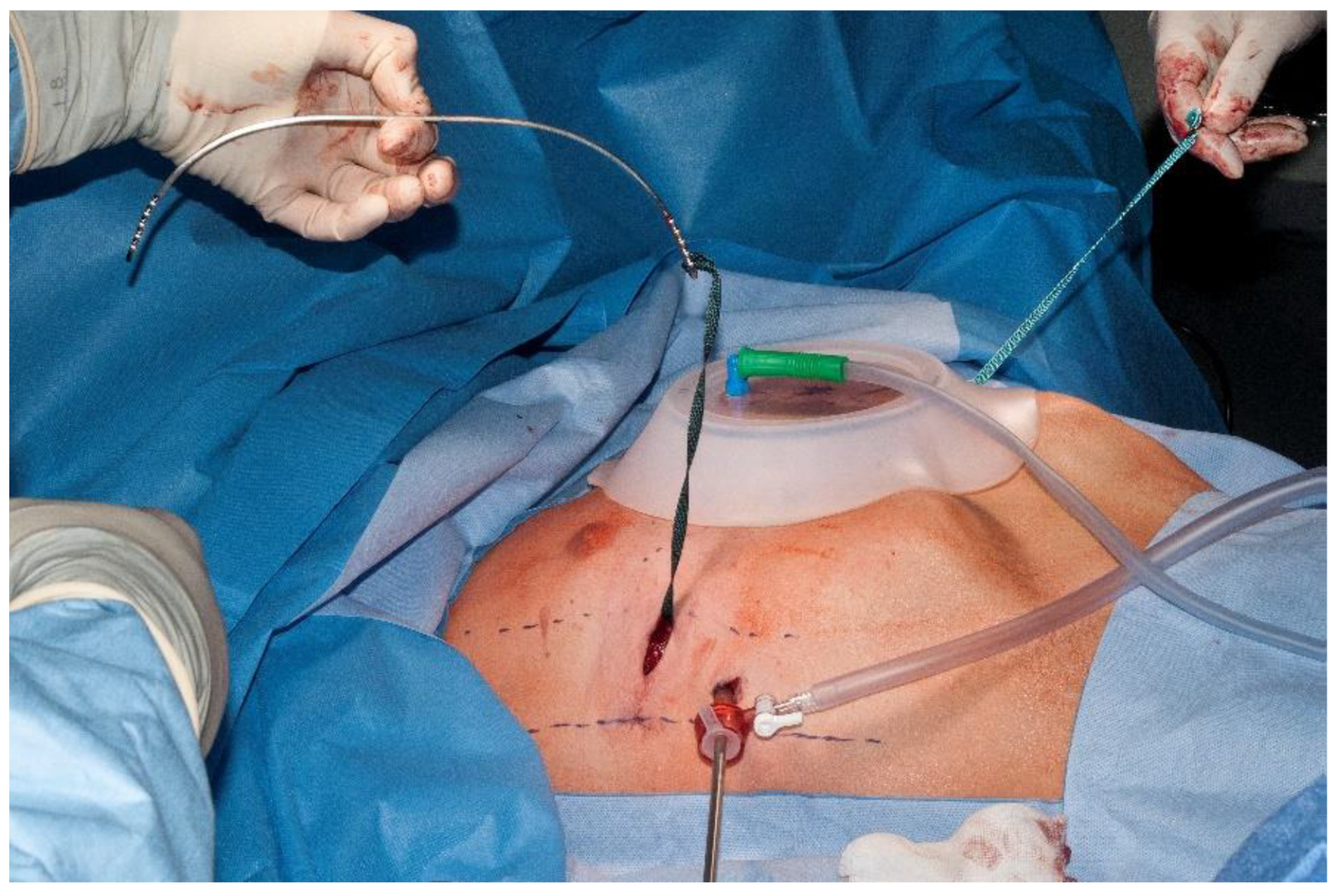 Children 09 00478 g003