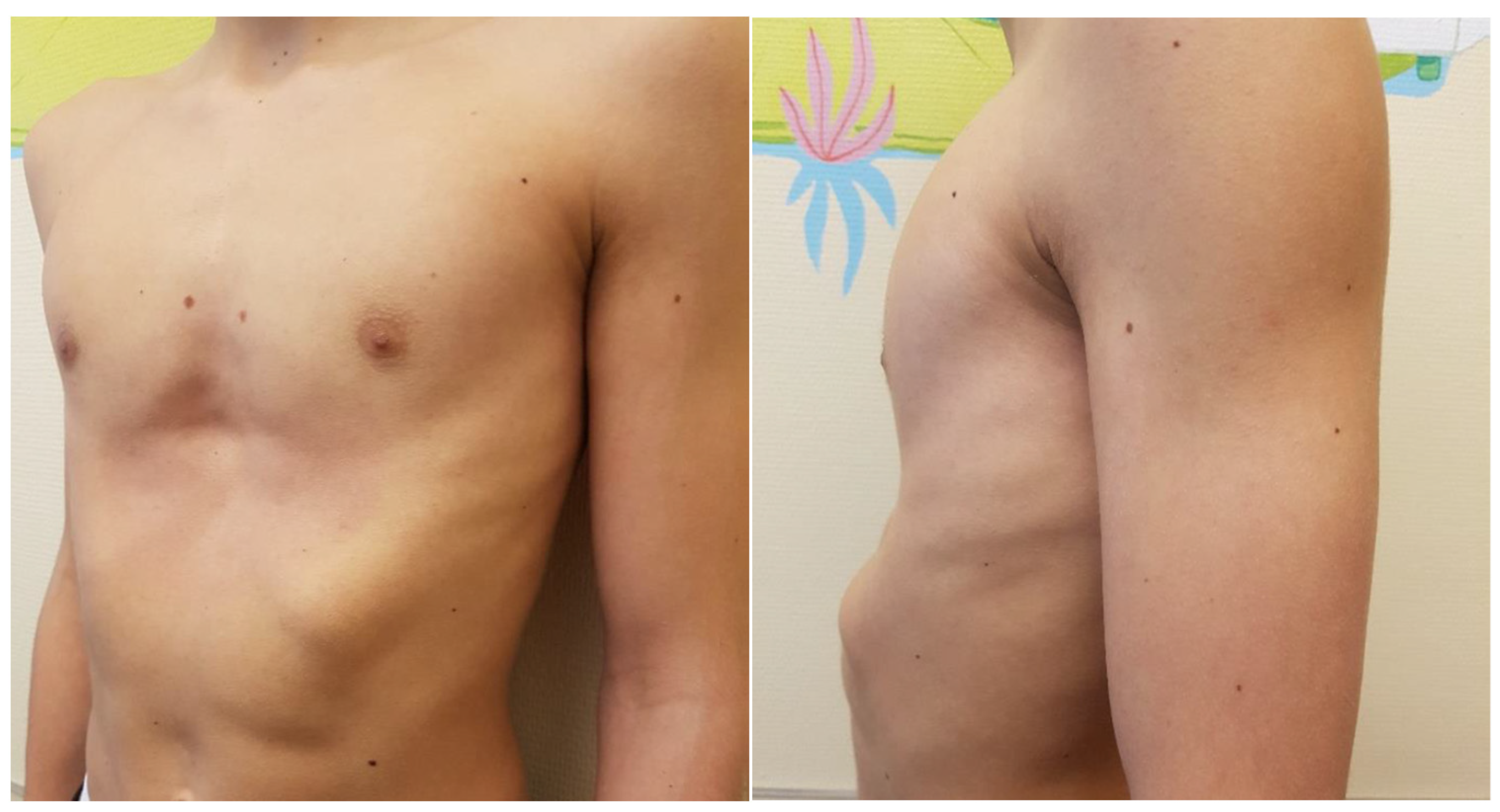 Children 09 00478 g004