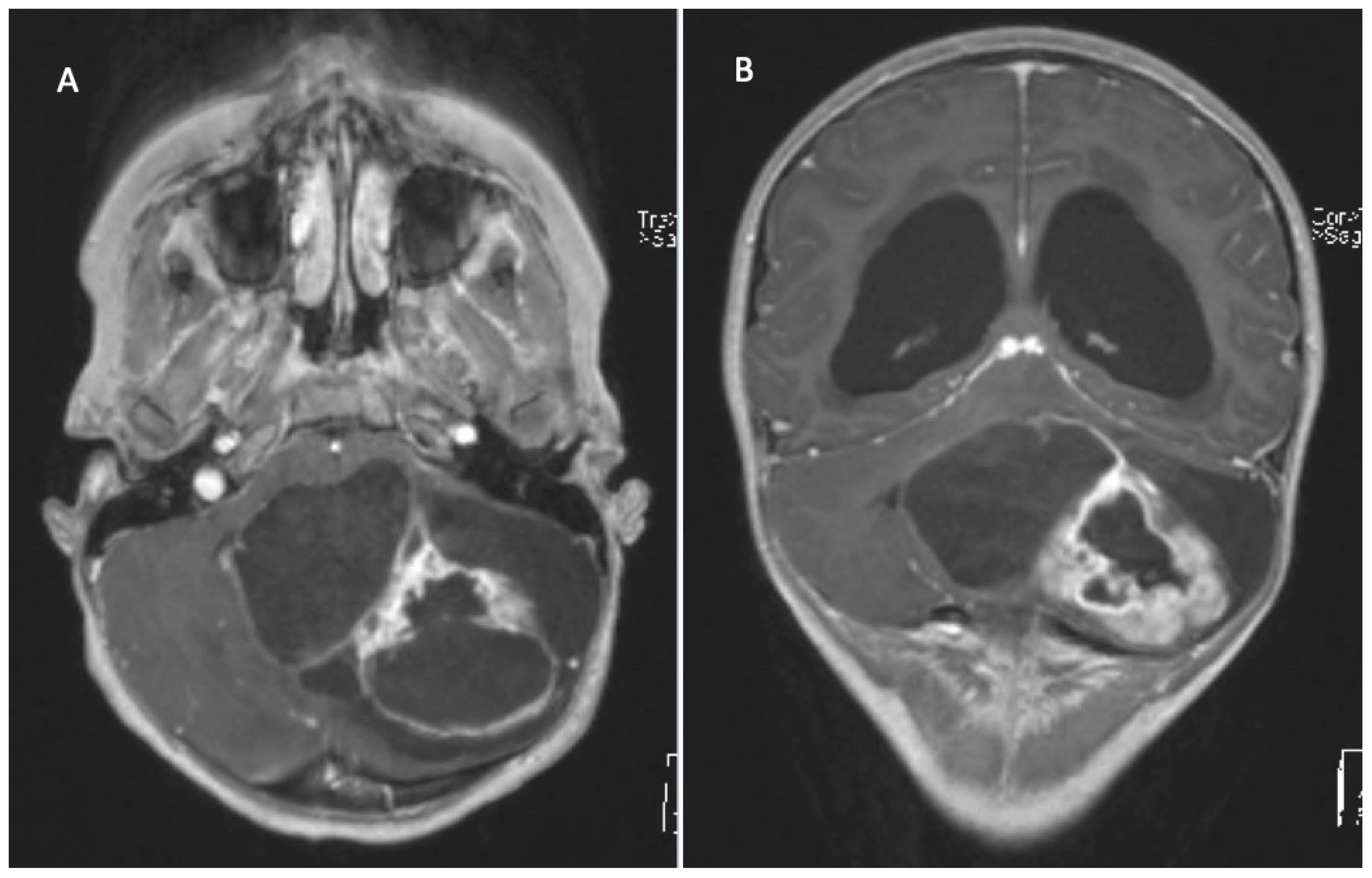 Children 09 00498 g003