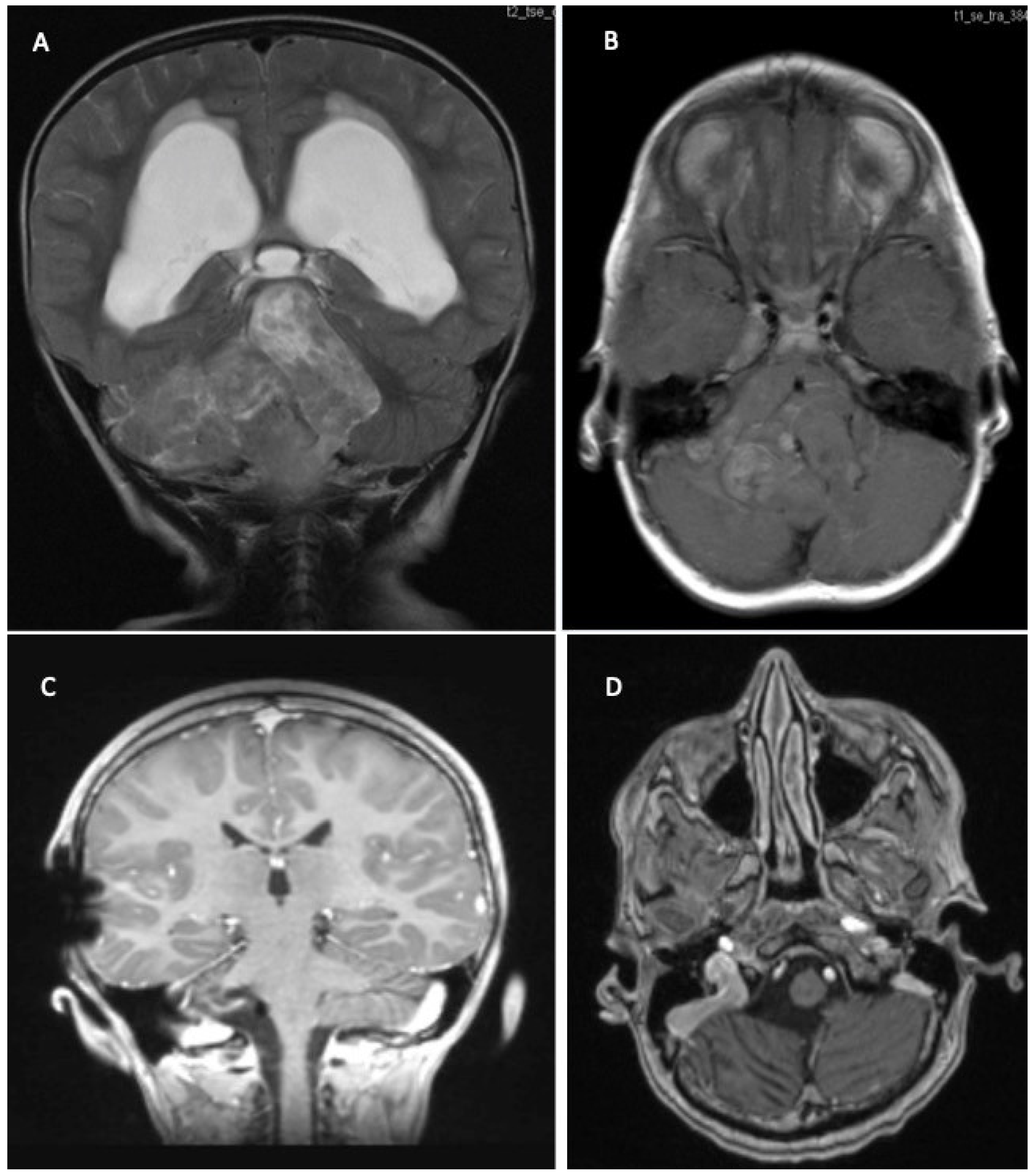 Children 09 00498 g005