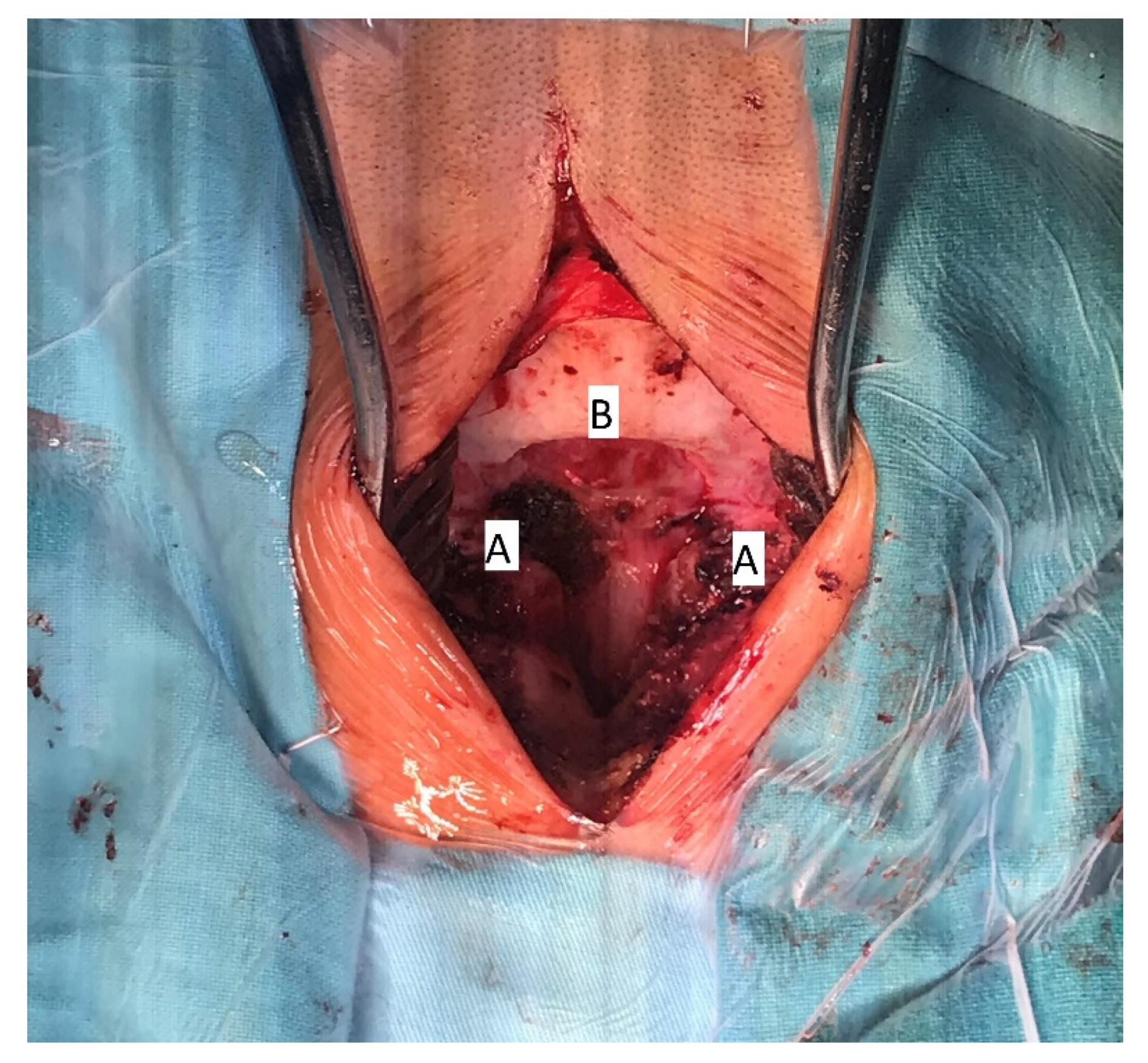 Children 09 00532 g004 550