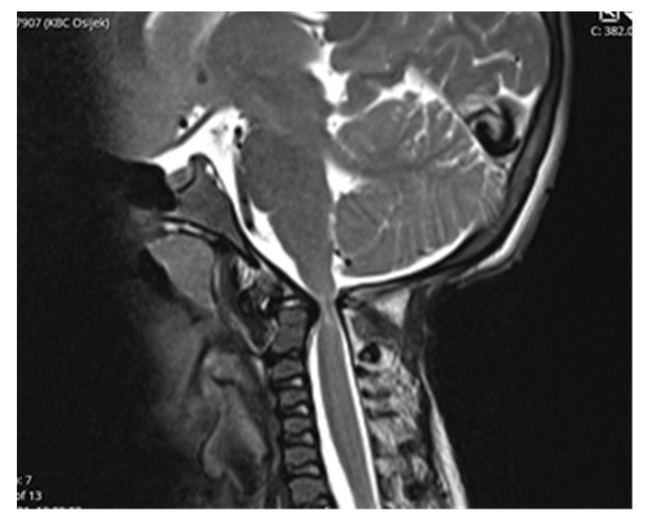 Children 09 00532 g005 550