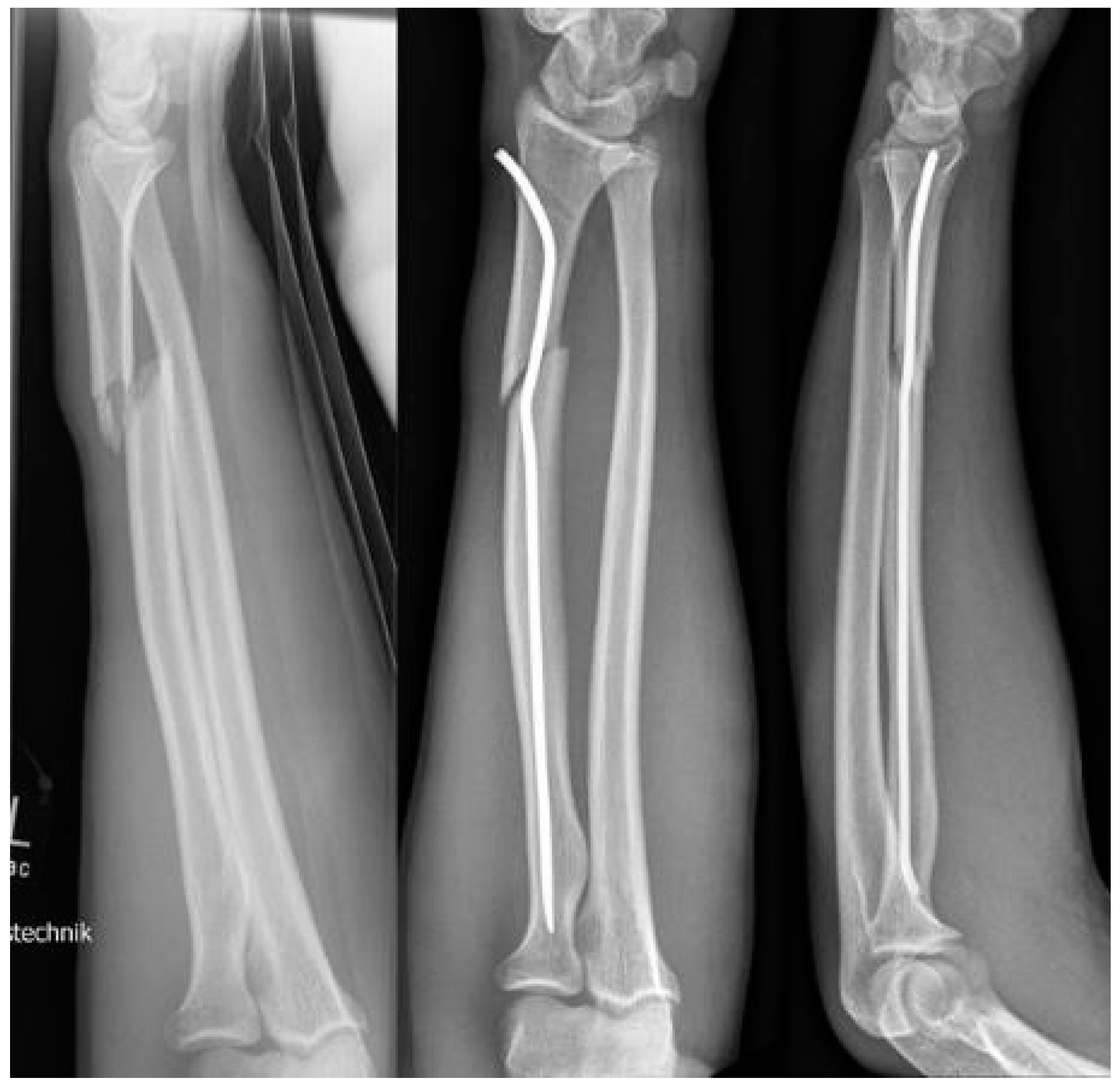 Children 09 00579 sch003 550