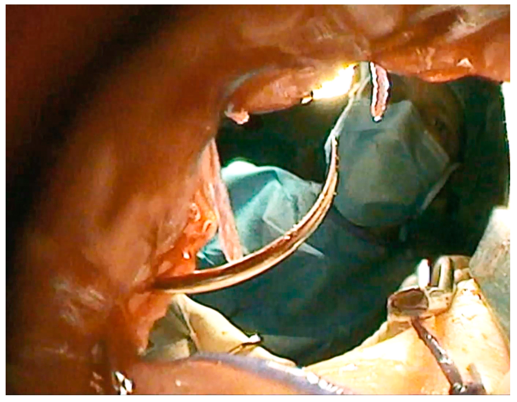 Children 09 00587 g004 550