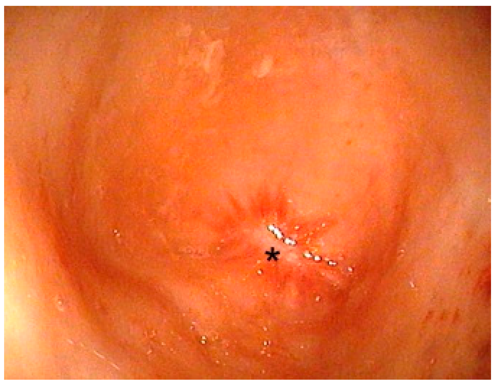 Children 09 00587 g005 550