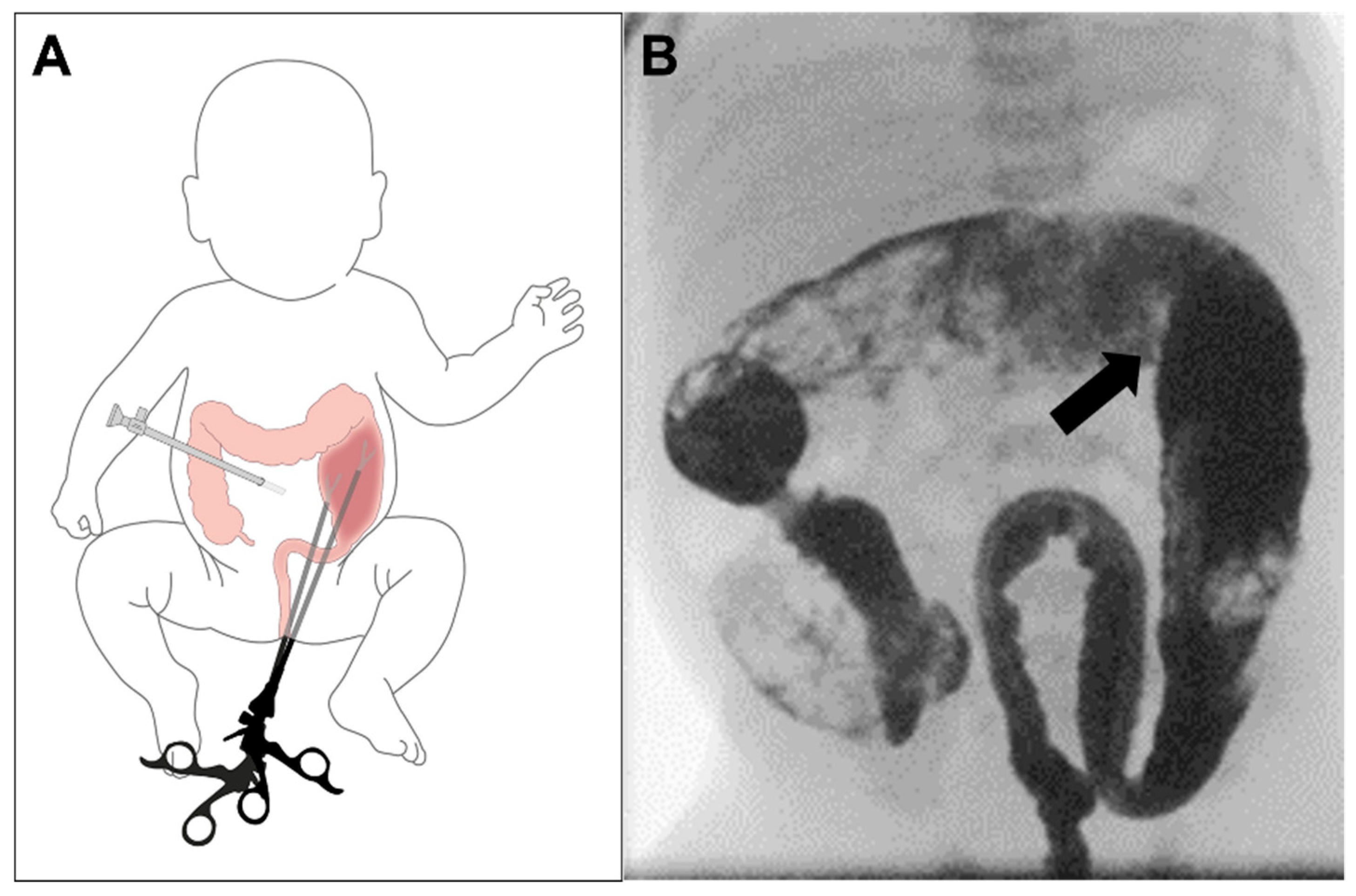 Children 09 00588 g003 Children 09 00588 g003