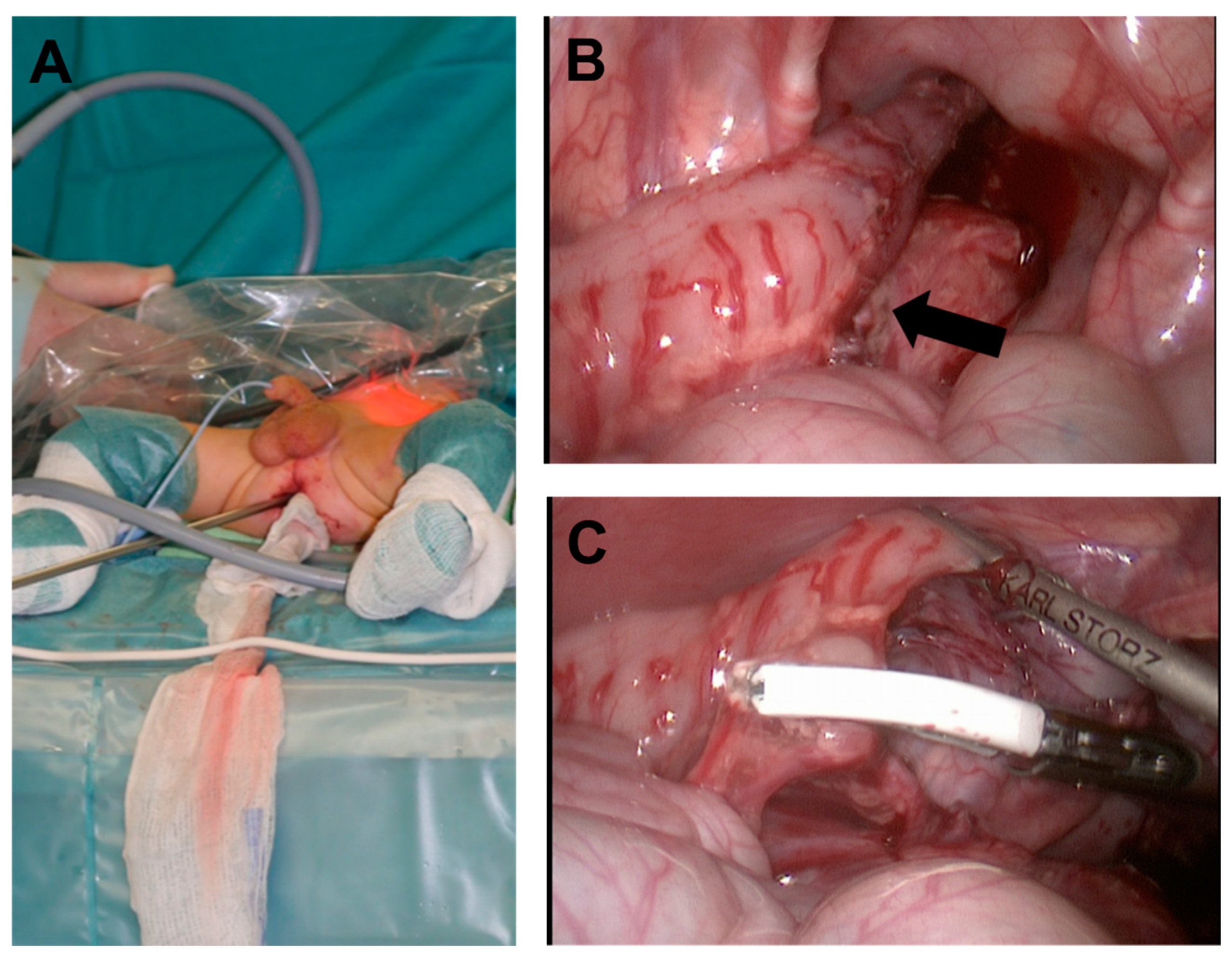 Children 09 00588 g004 Children 09 00588 g004